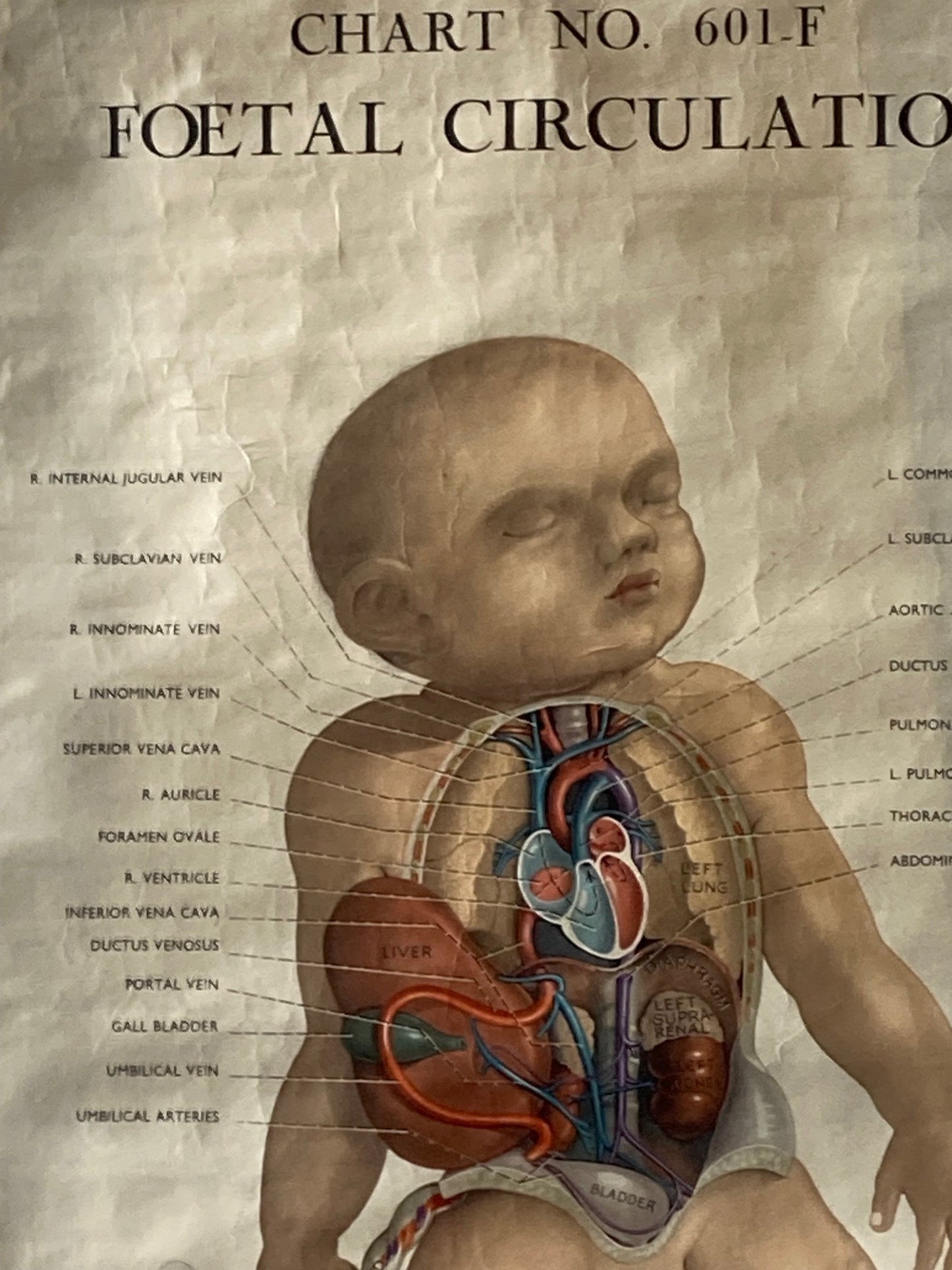 PAEDIATRICS Wall Chart Foetal Circulation , 1940's - Room Four