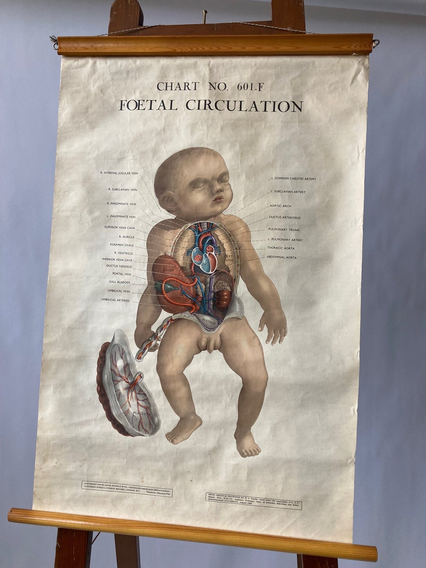 PAEDIATRICS Wall Chart Foetal Circulation , 1940's - Room Four