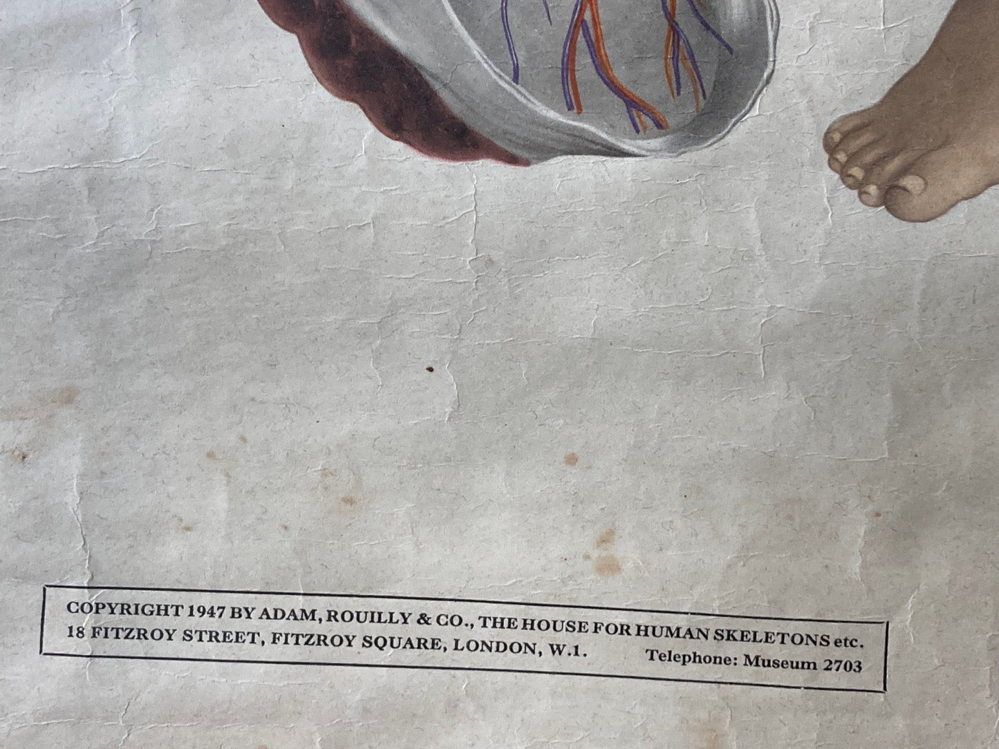 PAEDIATRICS Wall Chart Foetal Circulation , 1940's - Room Four
