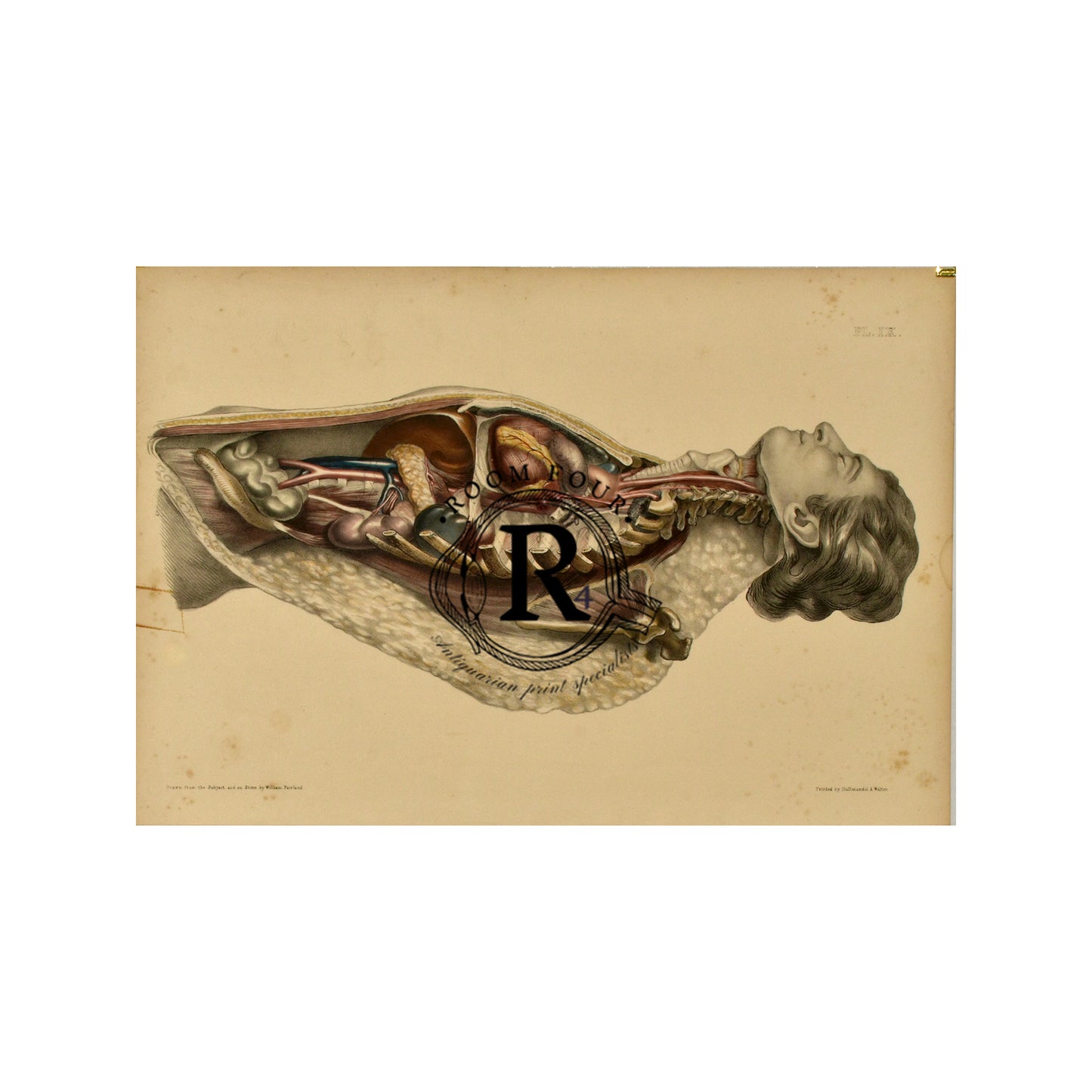 Human Anatomy Lithographic Print 19th Century - Plate XX