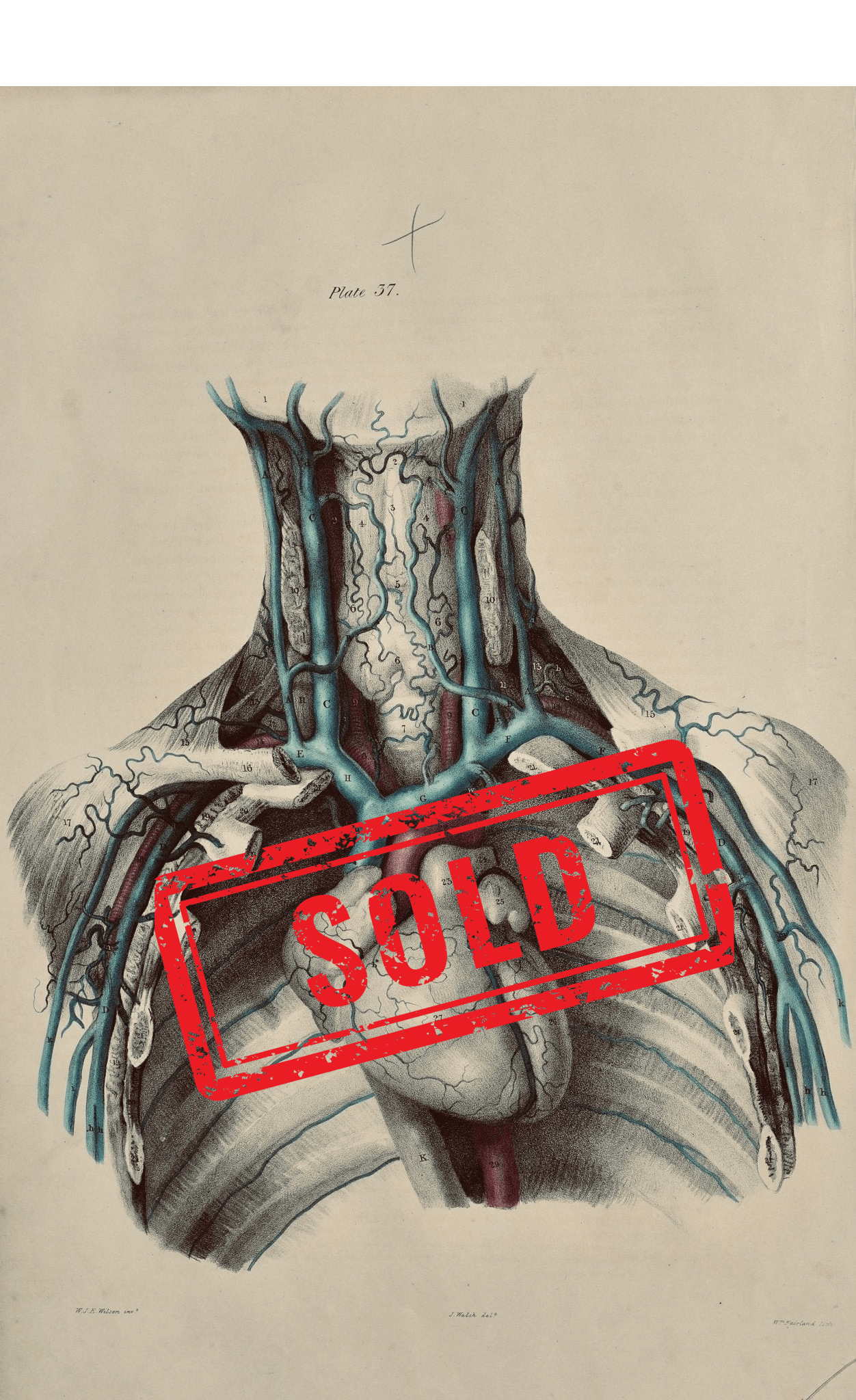 Sold – 19th Century Vascular Anatomical Drawing Plate 37 (Quain) - Room Four