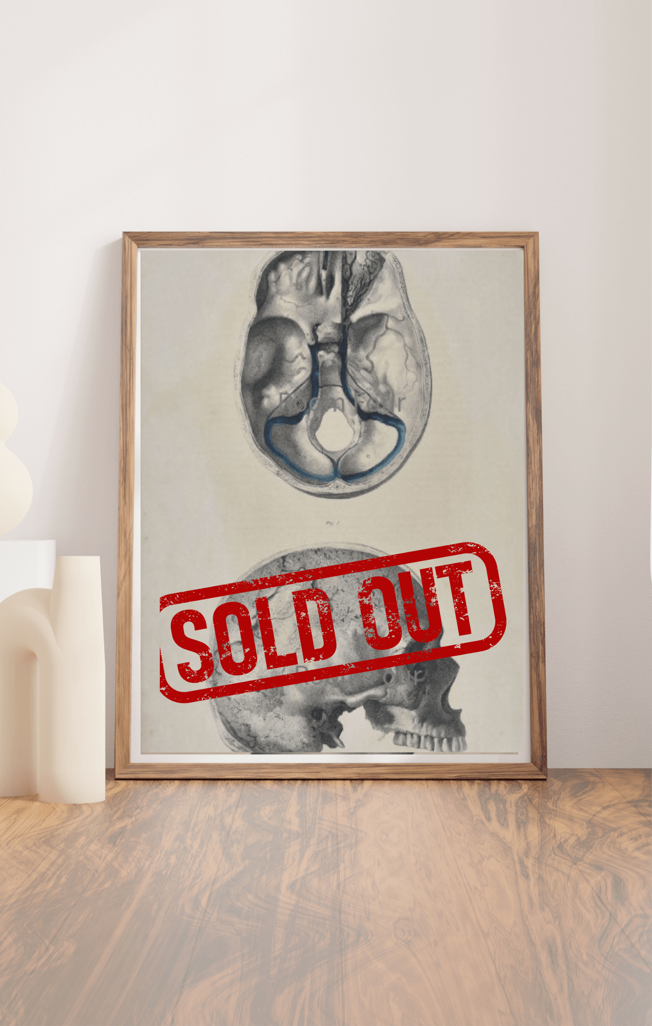 Sold – 19th Century Vascular Anatomical Drawing Plate 41 (Quain) - Room Four