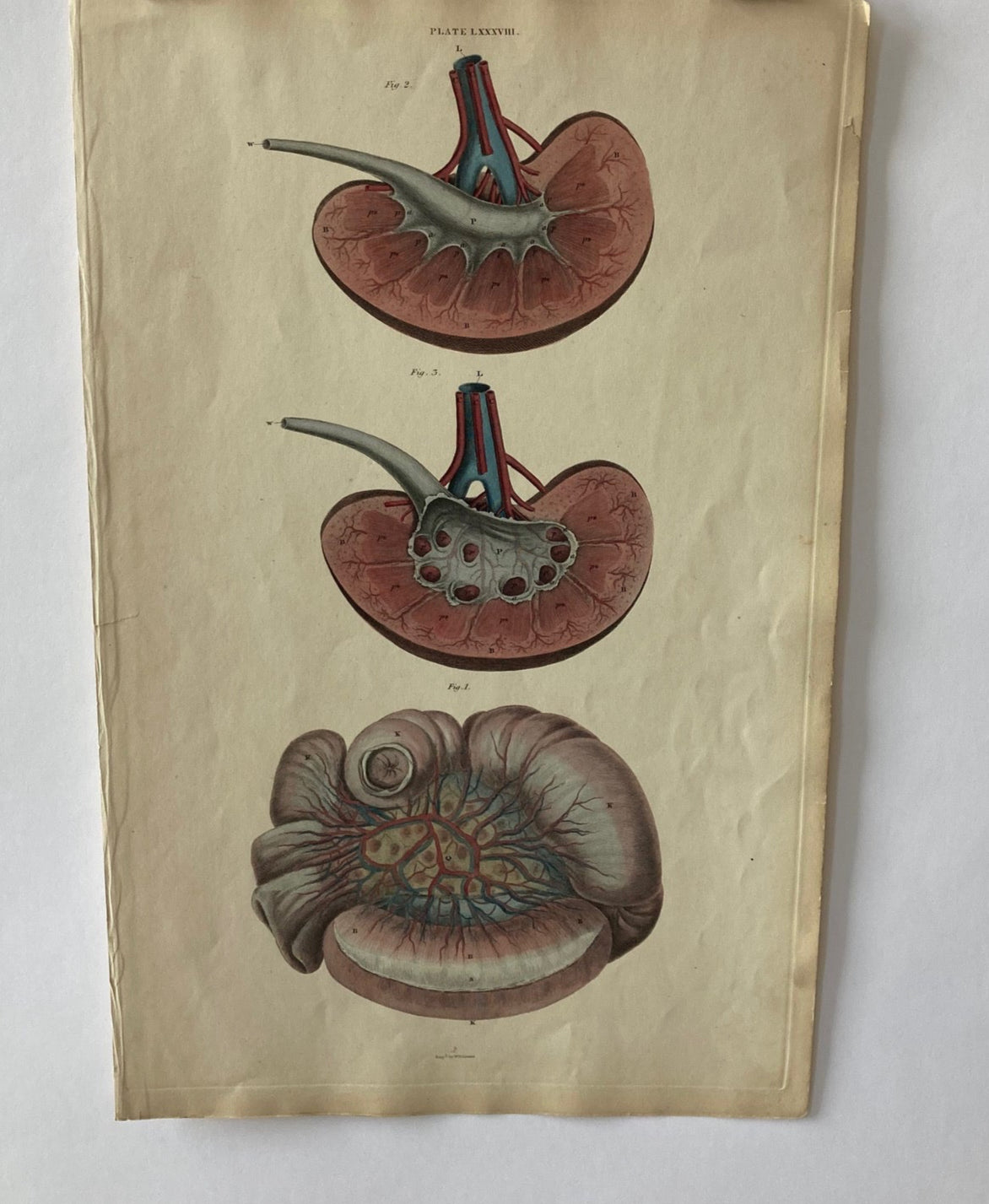 antique, anatomy, medical, print