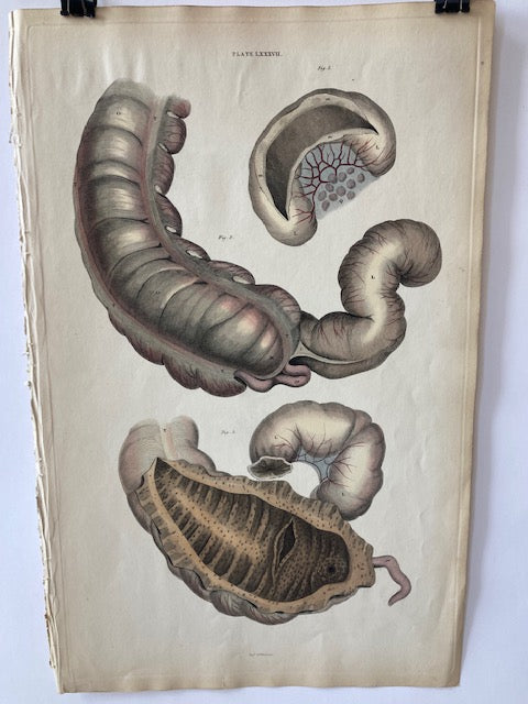 early anatomy - plate LXXXVII - ORIGINAL