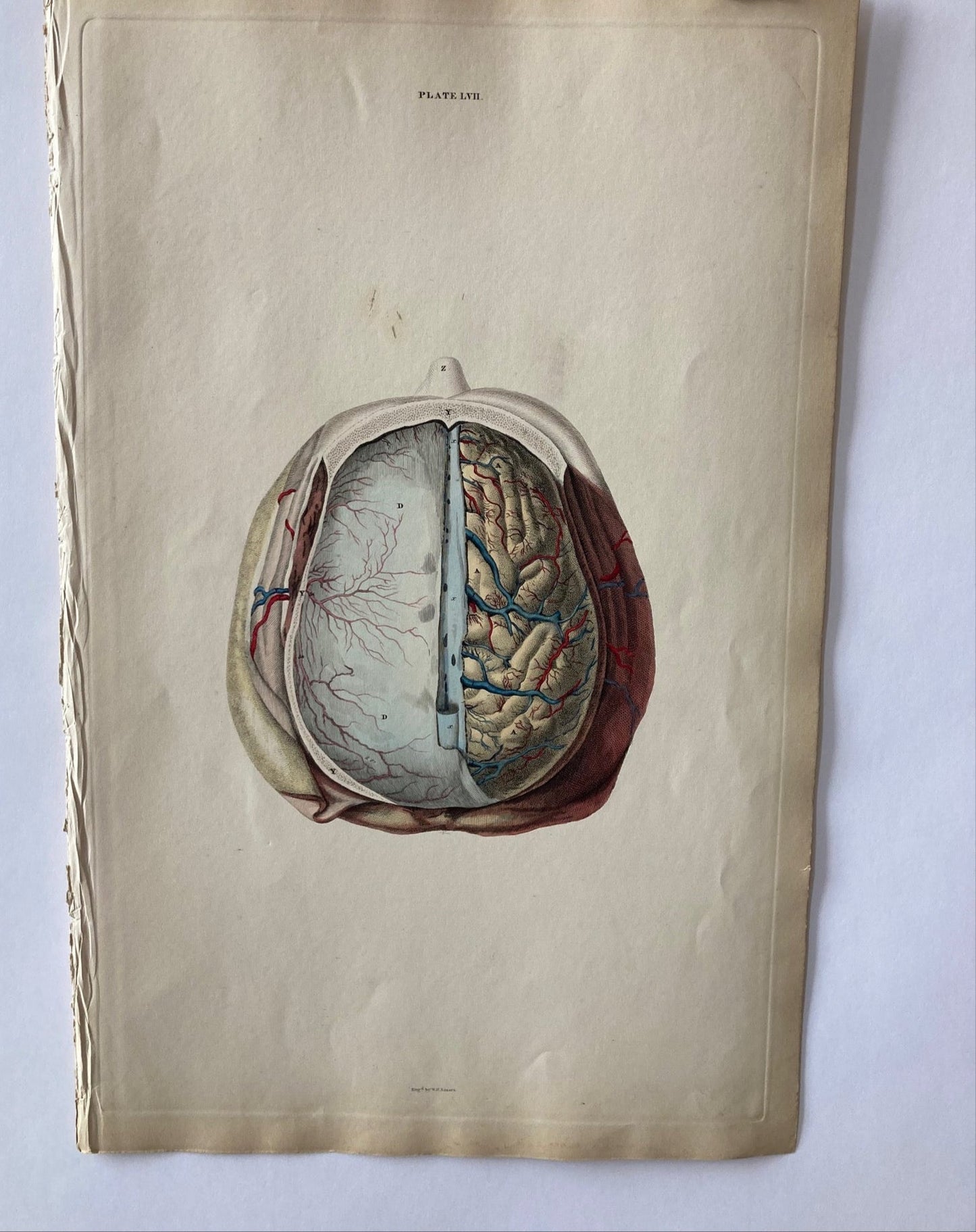early anatomy - plate LVII - original - Room Four
