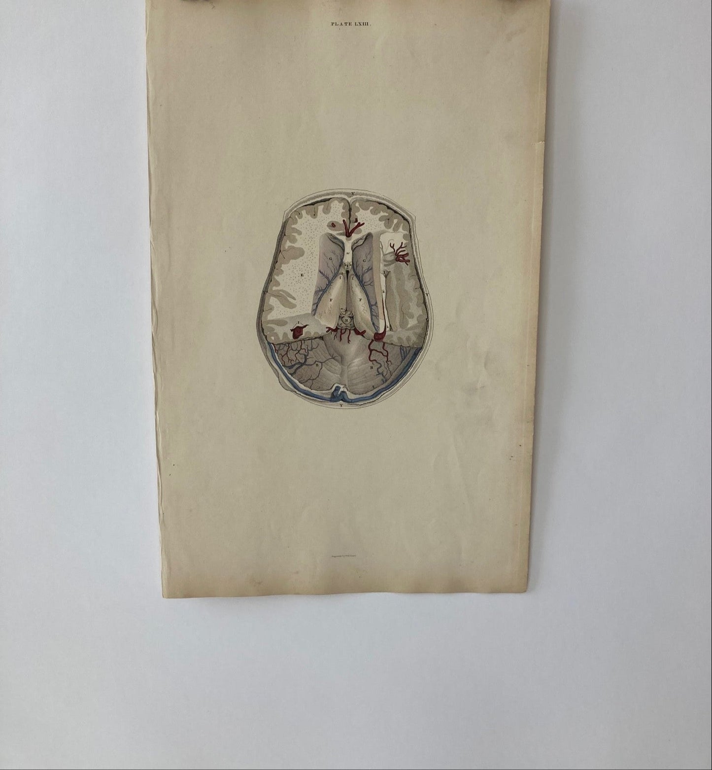 early anatomy - plate LXIII - original - Room Four