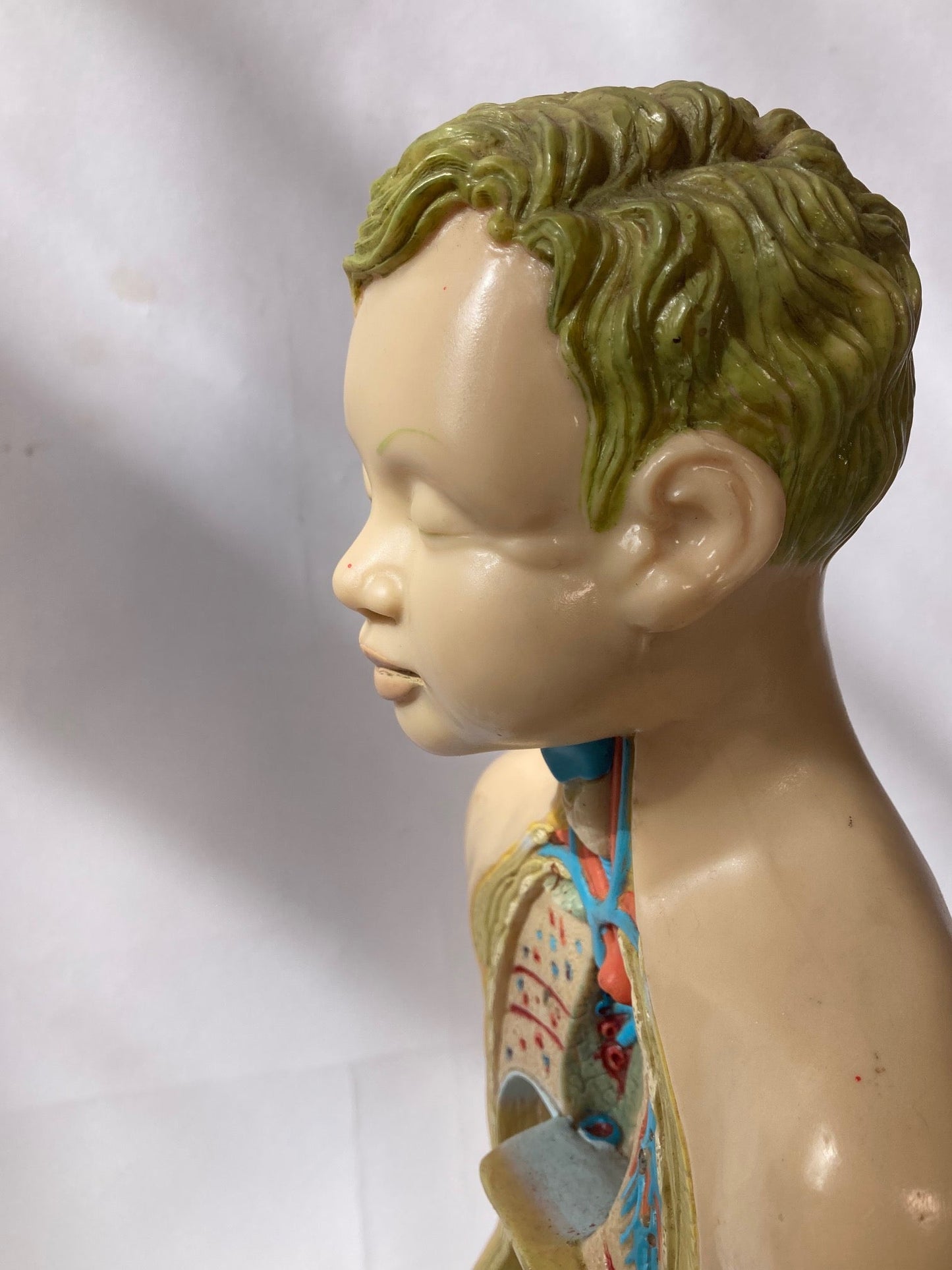 Rare Pædiatrics Teaching Aid / Anatomical model - Room Four