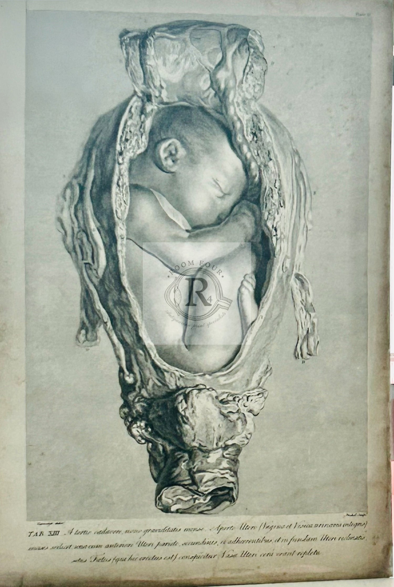 William Hunter Plate XXXIV – 18th-century copperplate engraving of full-term fetus in utero, antique medical illustration.