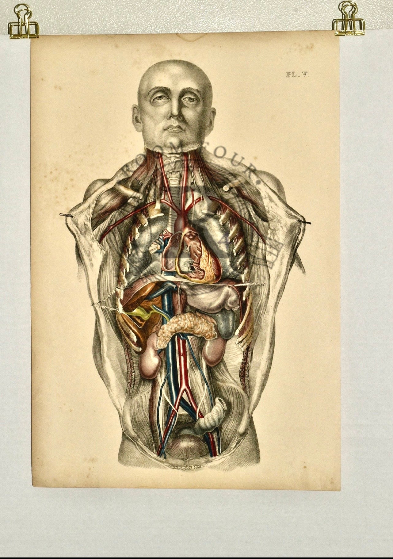 [Sibson] Victorian Medical Anatomical Print – Dissection Plate V (1869)