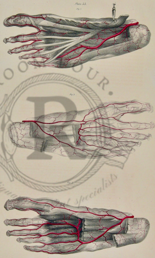 19th - Century Anatomical Drawing – Original Surgical Illustration - Quain Plate 33 - Room Four