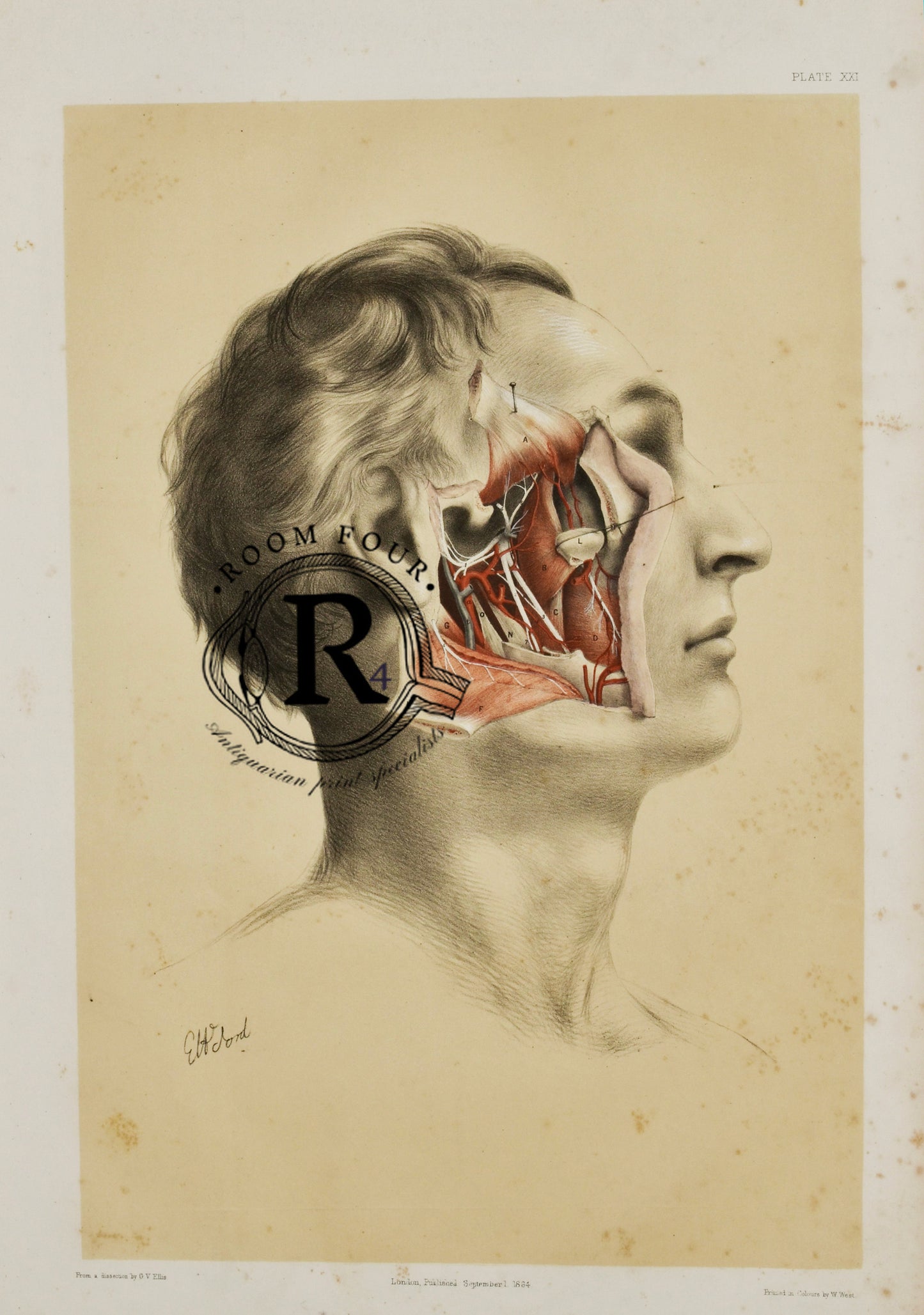 Anatomical Medical Dissection Drawing 19th Century Facial - Ford Structures - Ford
