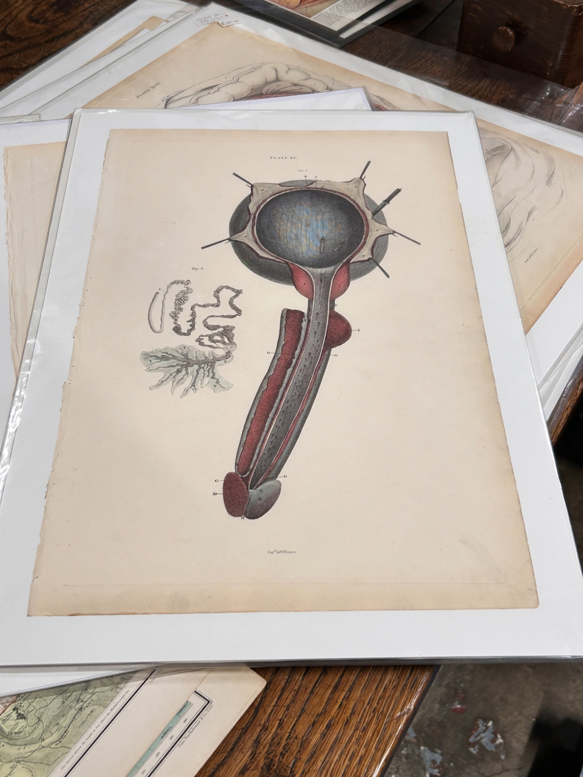 W. H. Lizars Anatomical Print — Male Reproductive Anatomy - Plate XC Reproduction