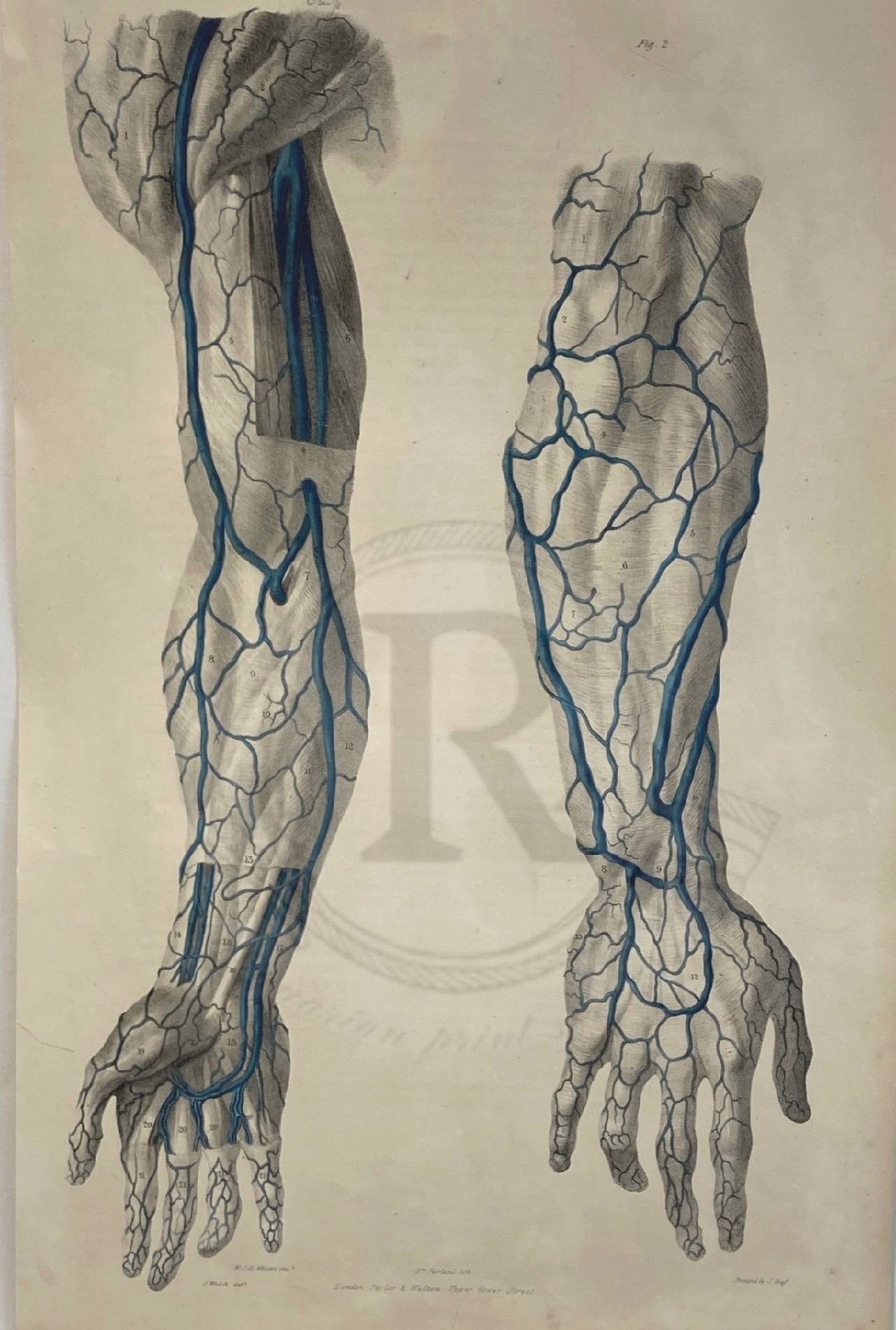 Anatomische Zeichnung aus dem 19. Jahrhundert – Gefäßdarstellung von Armen und Händen