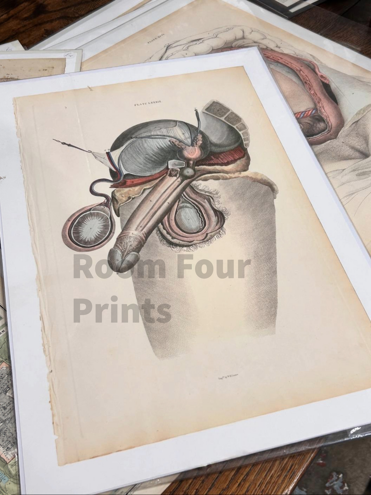 Frühe Anatomie – Tafel LXXXIII – ORIGINAL