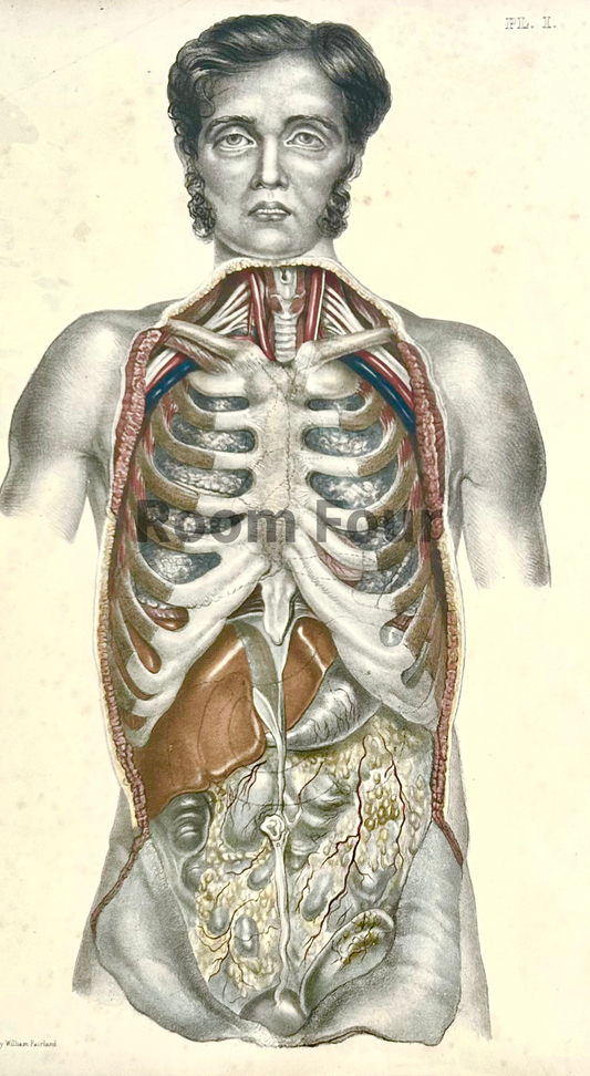 Sibson Anatomical Drawing – Original 19th‑Century Surgical Dissection Illustration