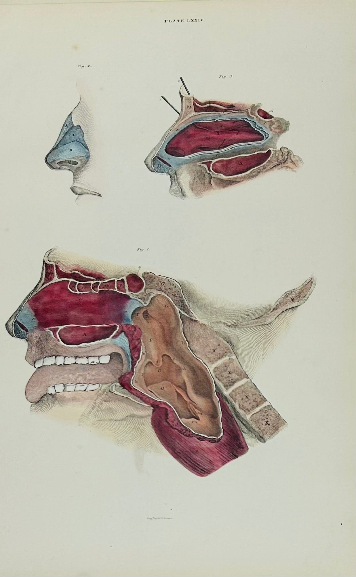 Lizars Anatomical Drawing Nasal Cavity Structures Plate LXXIV