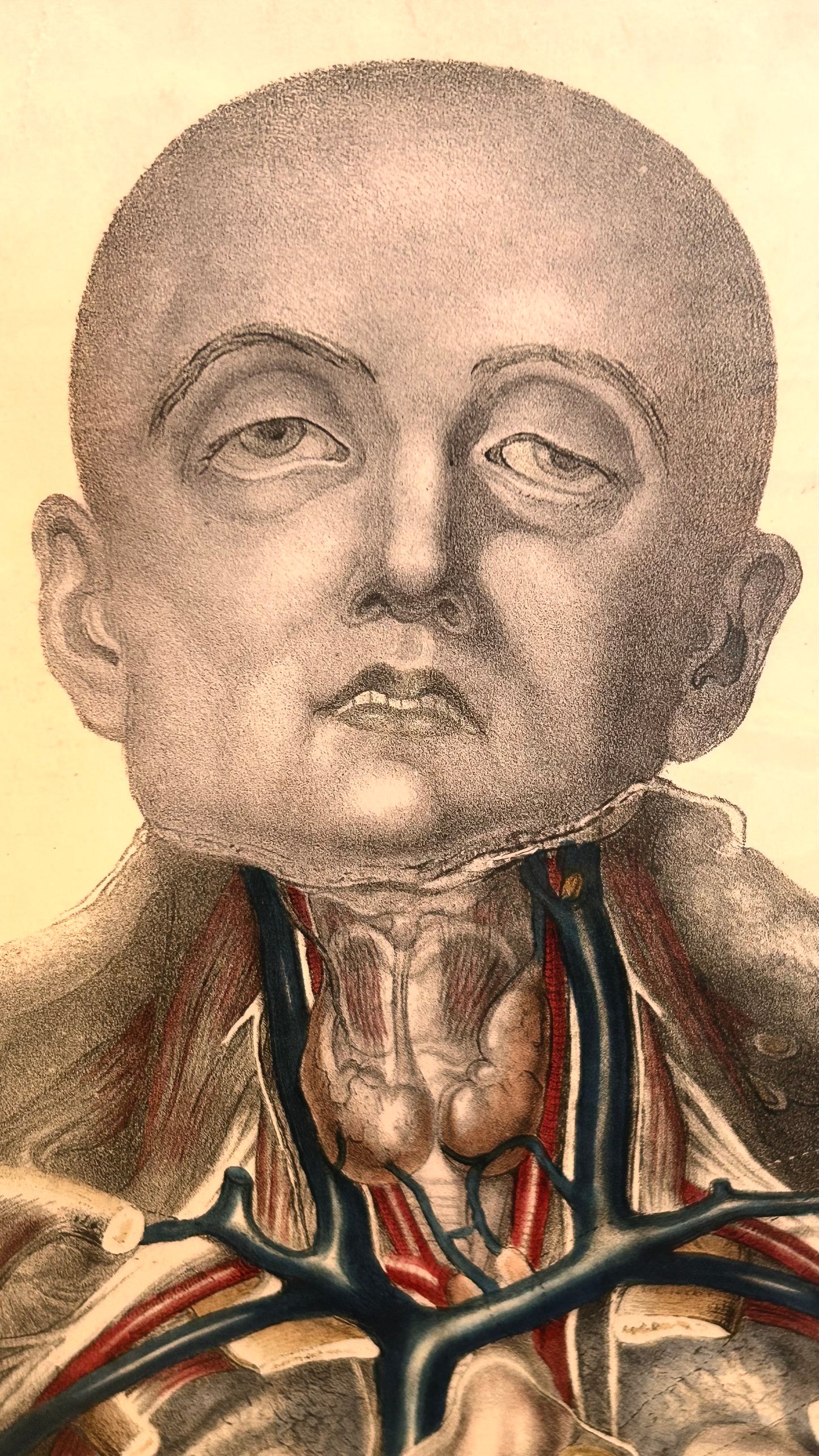 Sibson Anatomical Study Print – Human Torso & Organs, Manchester Royal Infirmary Dissection Plate IV 19th c.