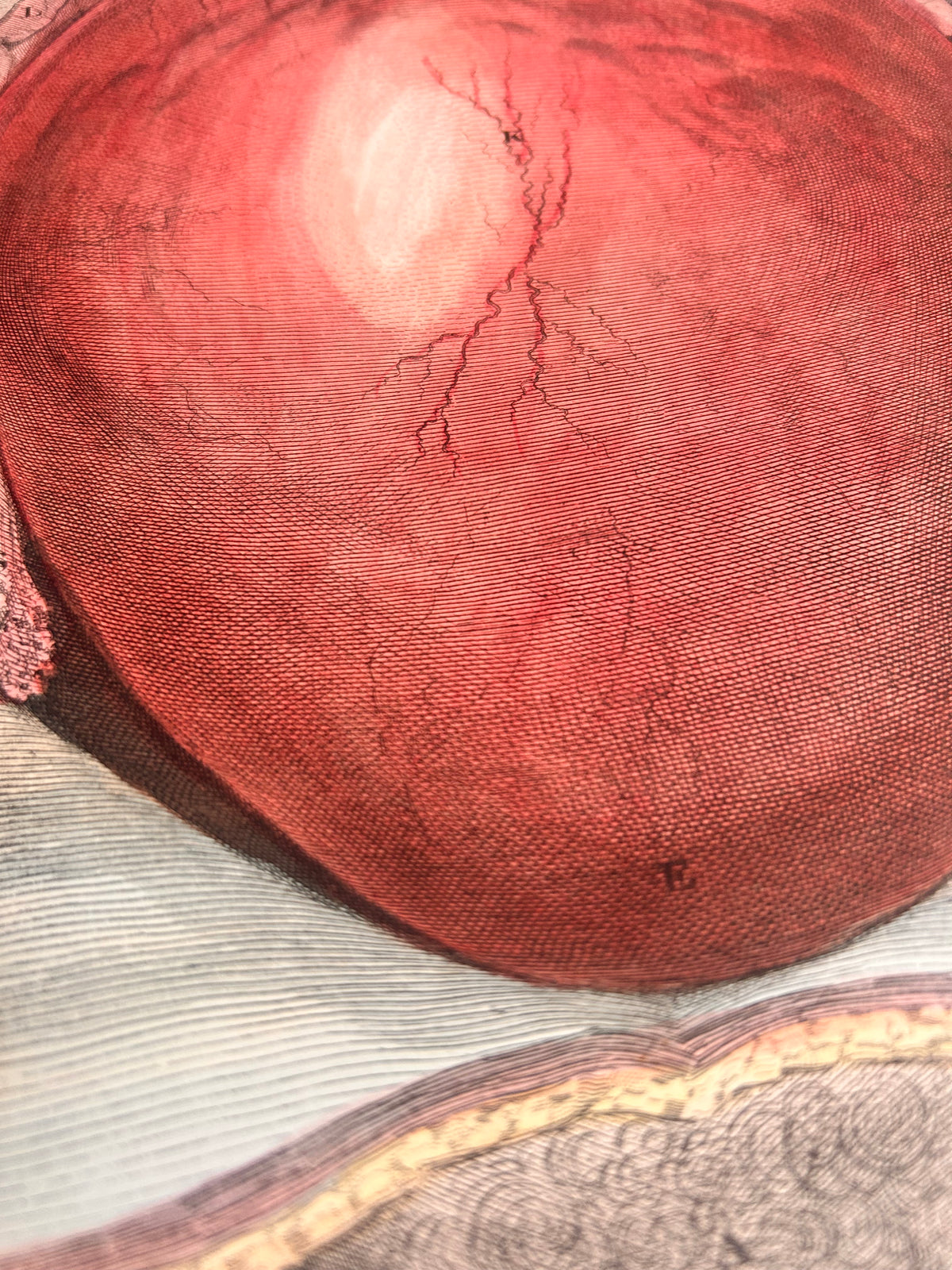 Antique Lizars Anatomical Engraving, Womb Dissection, Plate XCV, c. 1823–1827