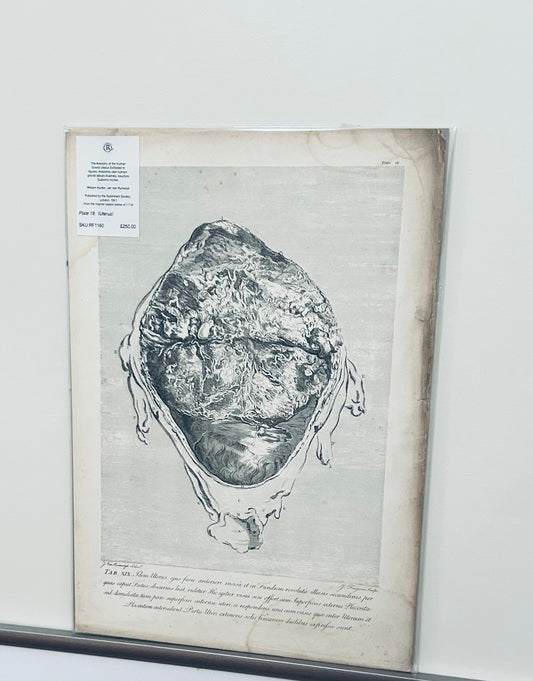 Utérus gravide humain - Dessins anatomiques de William Hunter, planche 19