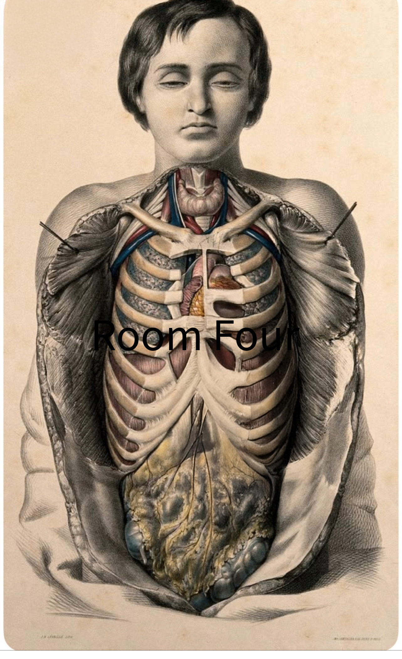 [Sibson] Victorian Medical Anatomical Print – Dissection Plate XX (1869)