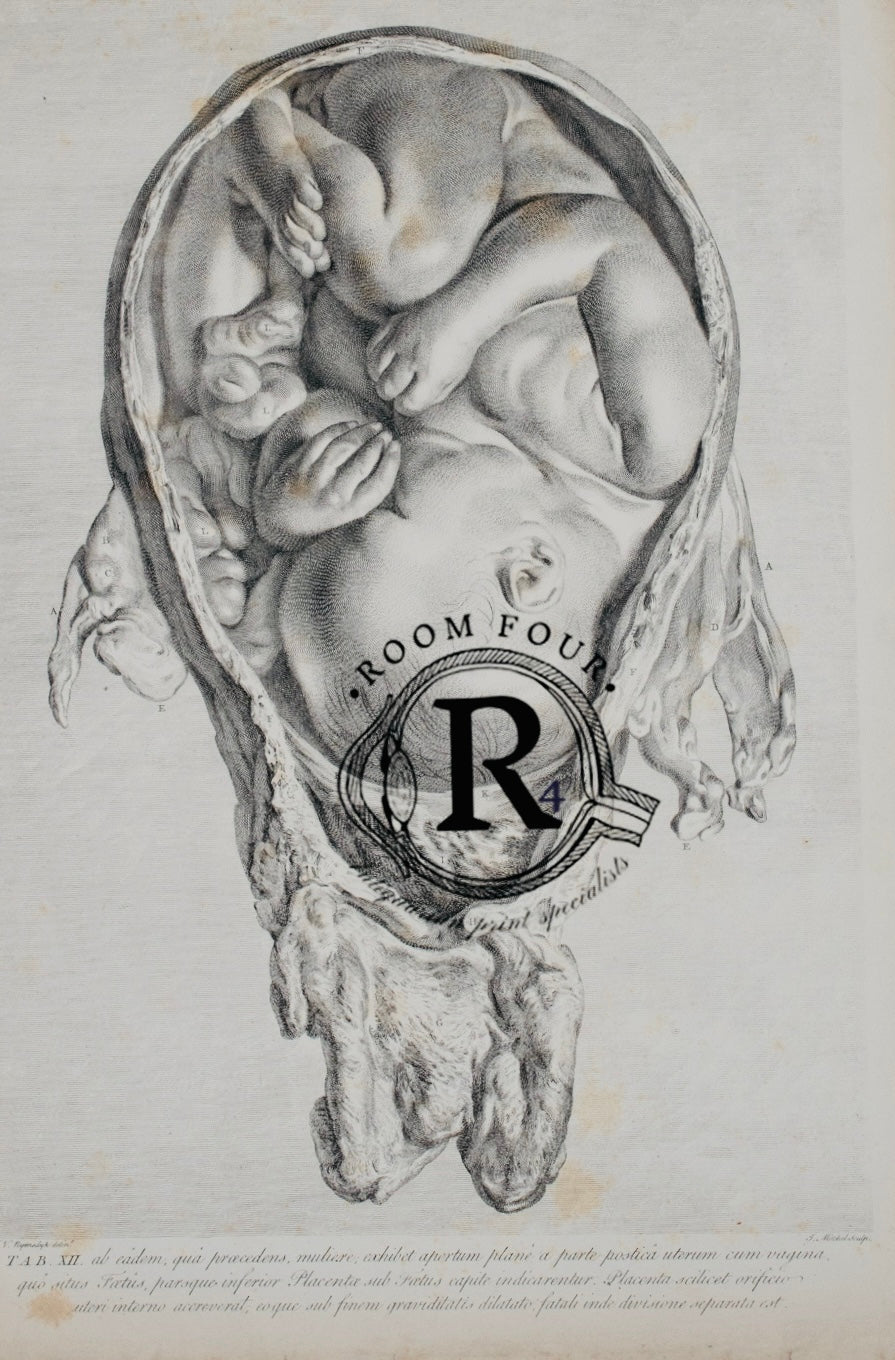 Antique Medical Print - William Hunter 1774 - Full Term Foetus – Plate XII | Original - Enlightenment