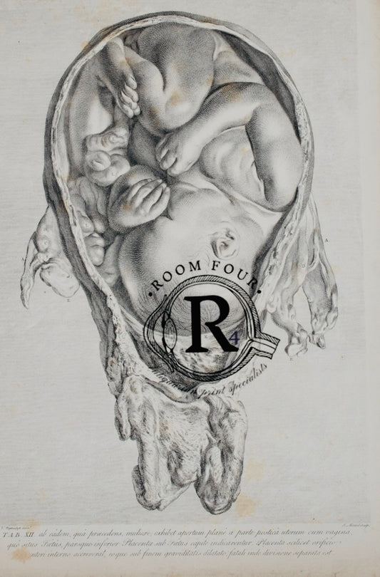 Antique Medical Print - William Hunter 1774 - Full Term Foetus – Plate XII | Original - Enlightenment