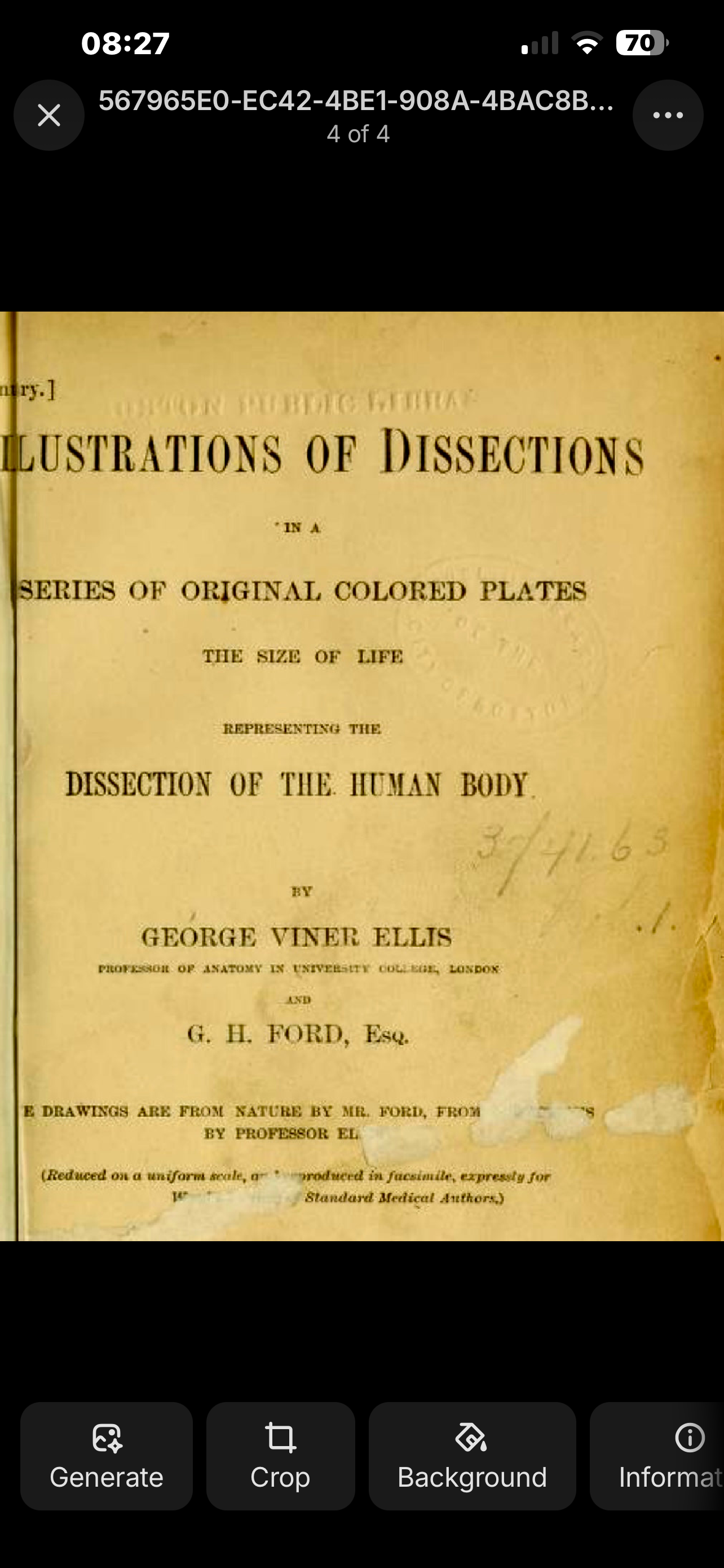Ellis & Ford Anatomical Lithograph — Illustrations of Dissections, Plate XXXIX — Male Abdominal Dissection (1866) | Original 19th‑Century