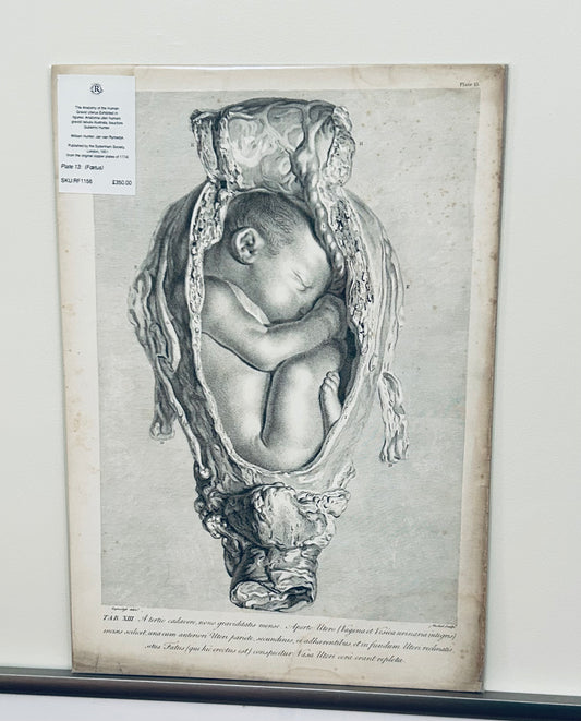 William Hunter (1774) – Original Copperplate Engraving Tab XIII Plate 13 Gravid Uterus 