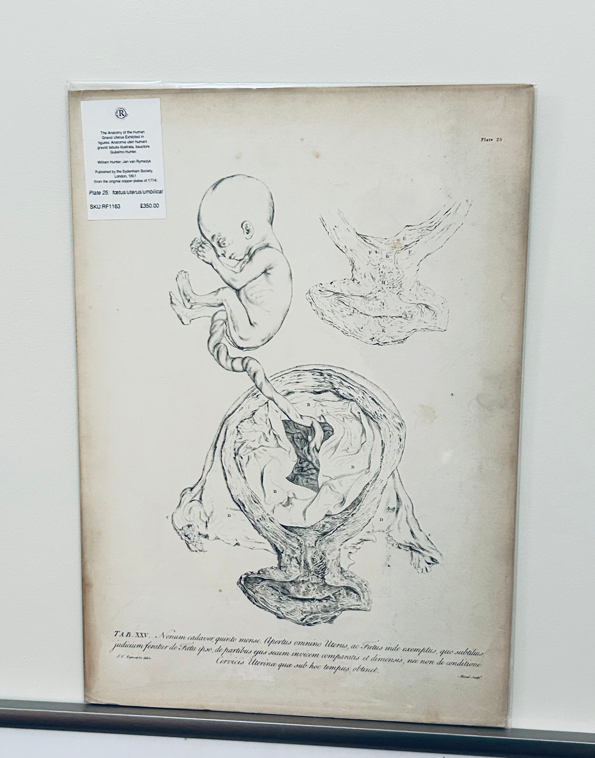 William Hunter Anatomical Drawing – Gravid Uterus Plate 25 | Antique Medical Print