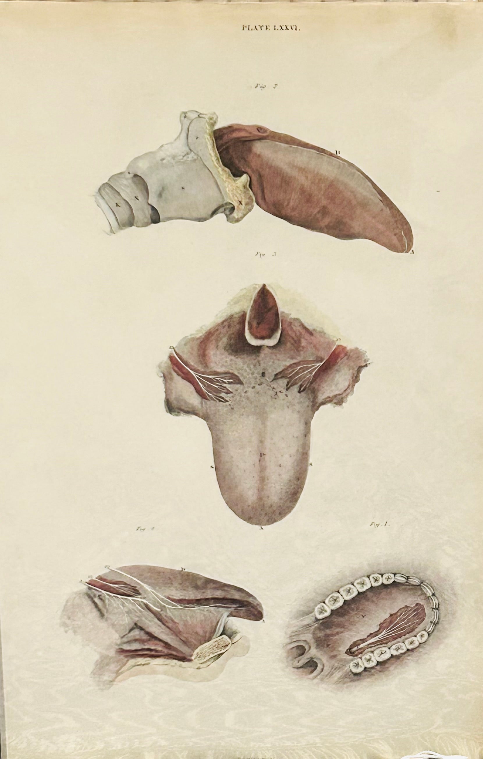 Antique anatomical illustration labeled “PLATE LXXVI” showing five detailed dissections of the human tongue and oral structures.