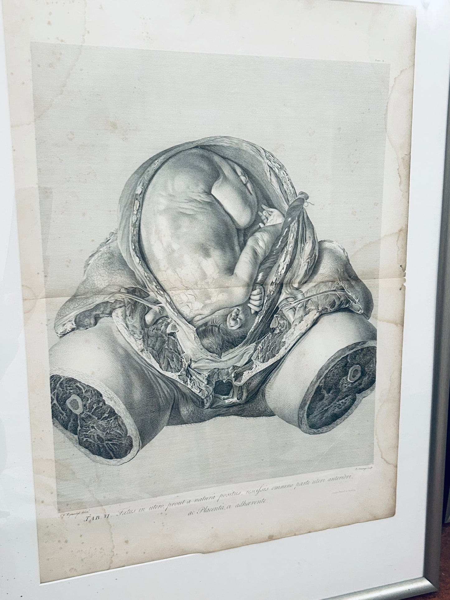 Anatomischer Kupferstich von William Hunter – Tafel XXXIV, Kupferstich aus dem 18. Jahrhundert, Fötus im Mutterleib