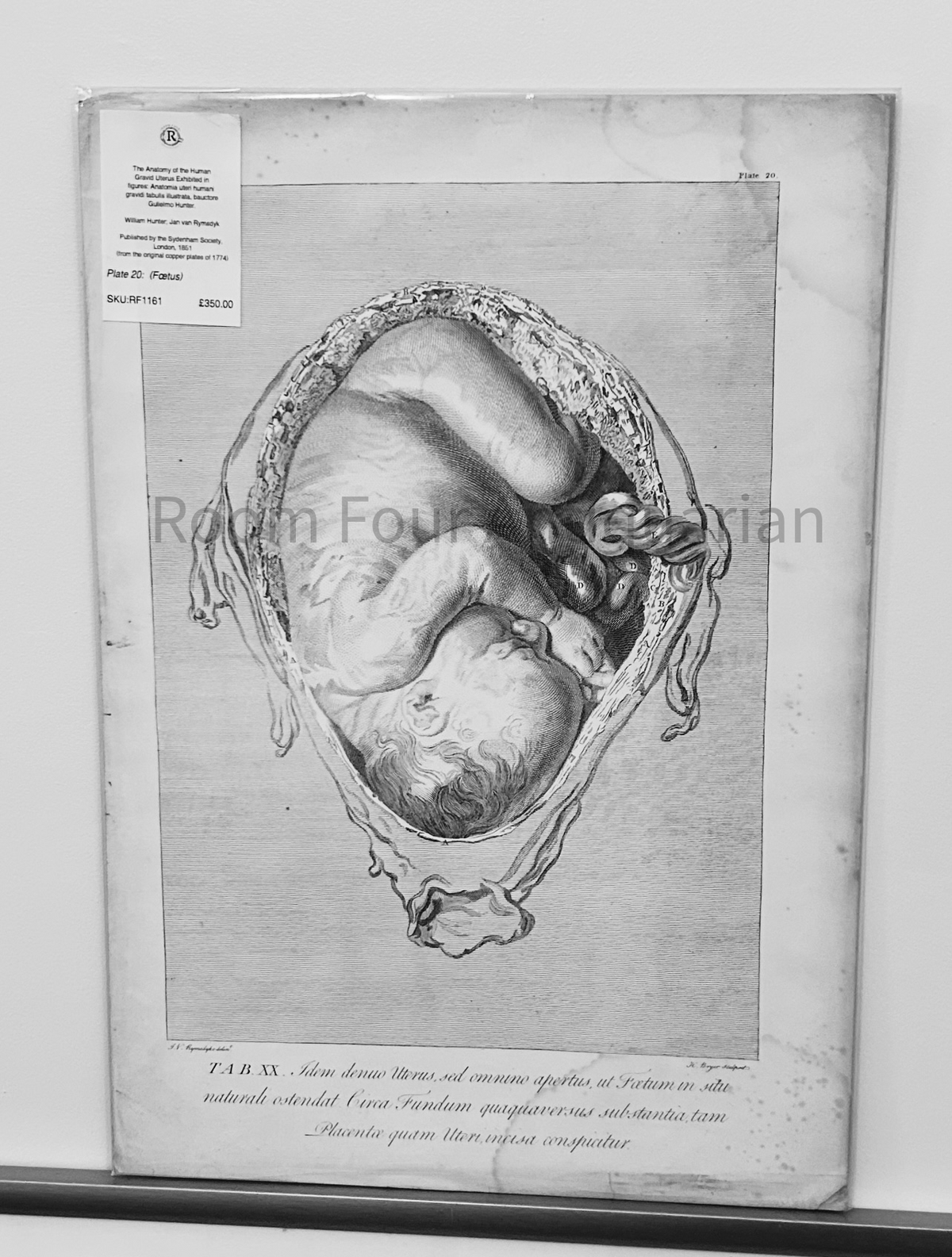 William Hunter Anatomical Drawing - Human Gravid Uterus - Tab XX