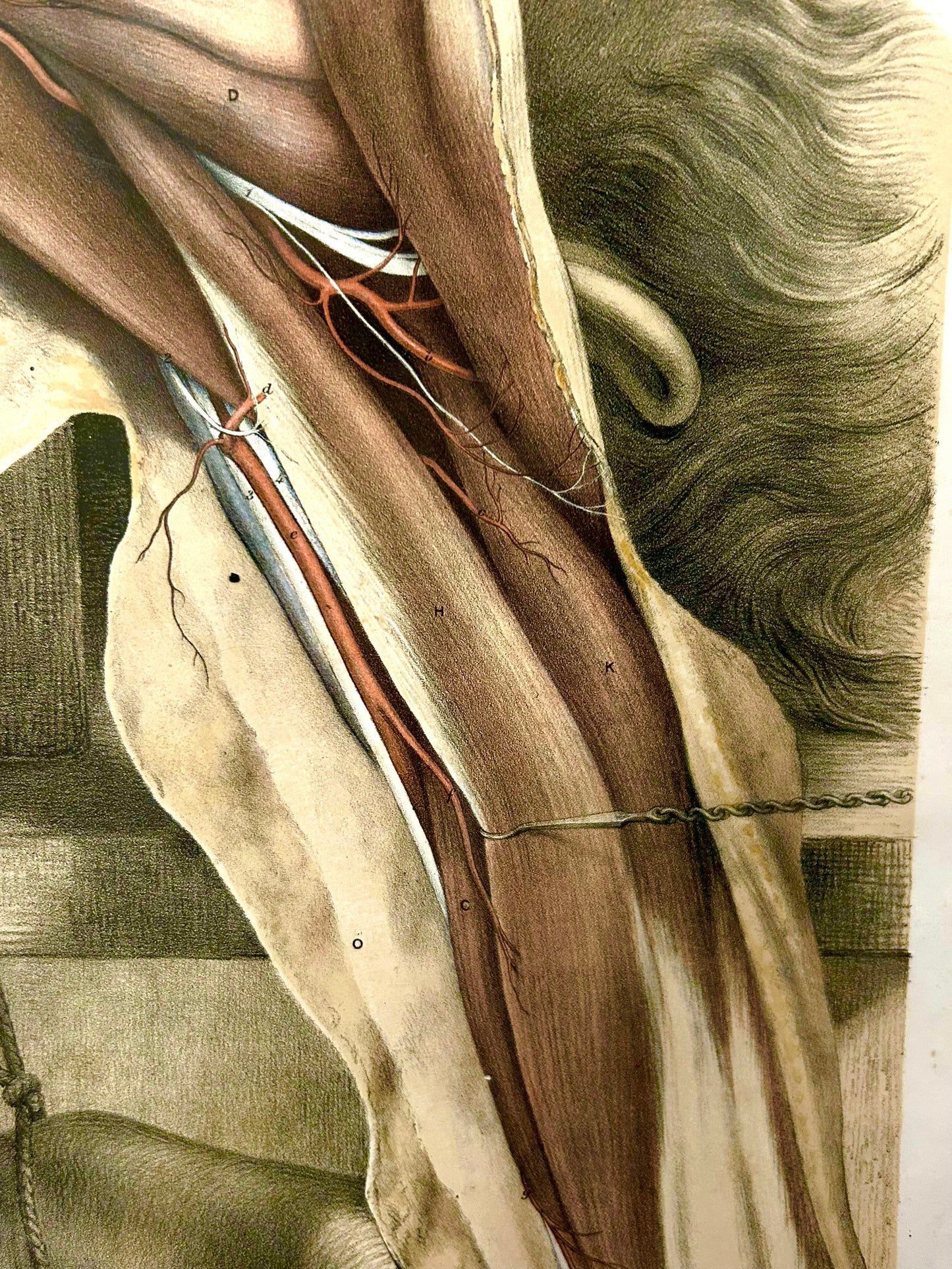 Victorian Anatomical Drawing 1863 by Ford – Antique Medical Illustration Plate VI / Arteries of the Arm & Shoulder