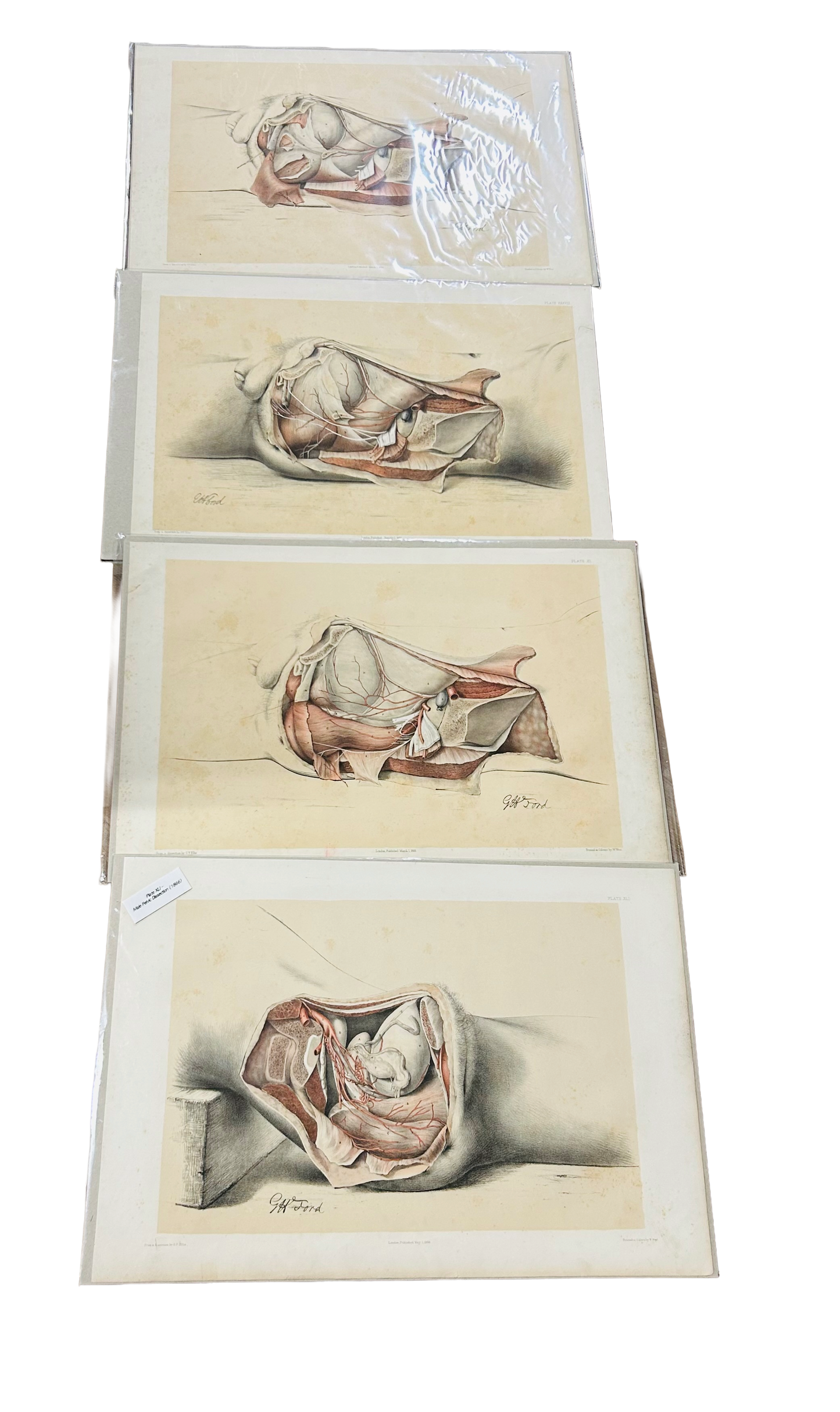 Anatomische Sektionszeichnung, Unterkörper, Tafel XLI, 19. Jahrhundert