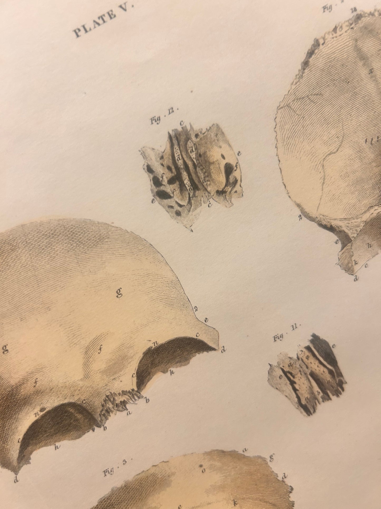 Human Skeleton Wall Art – Antique Anatomy Print