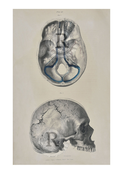 Anatomical Skull Print Fine Art Reproduction
