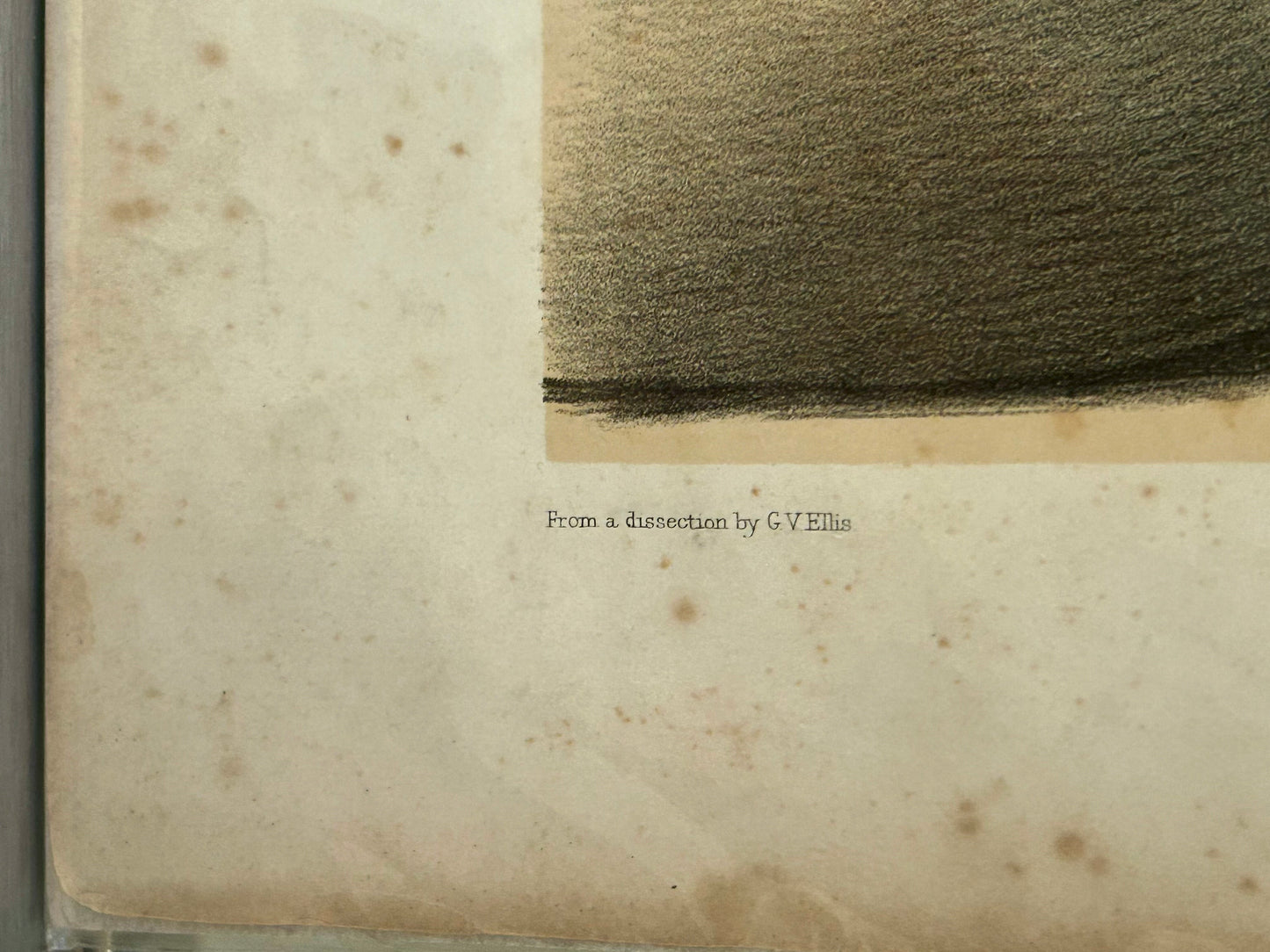 Victorian Anatomical Drawing 1863 by G H Ford –  Neck Anatomy Antique Medical Illustration / Plate XV