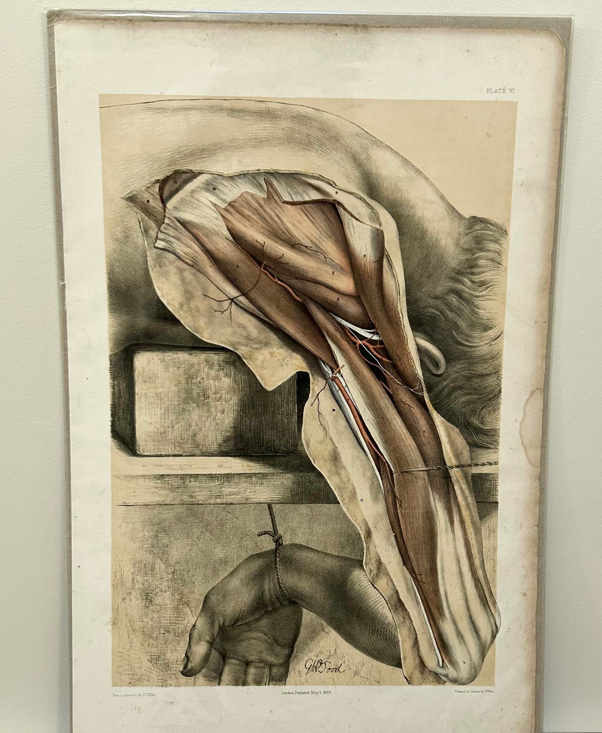 Victorian Anatomical Drawing 1863 by Ford – Antique Medical Illustration Plate VI / Arteries of the Arm & Shoulder