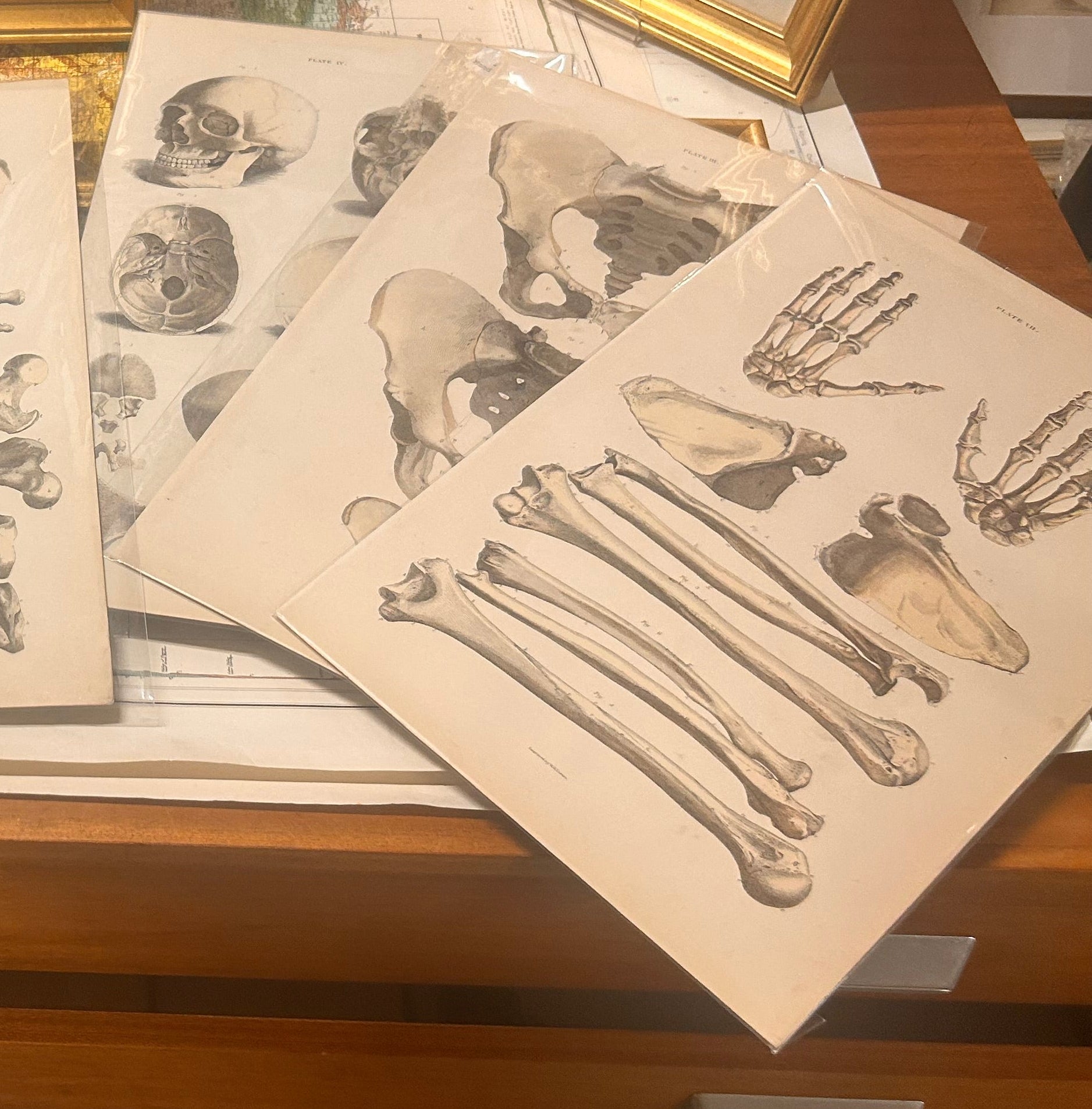 Anatomical Bones of the hand by Lizars 19th century original print 
