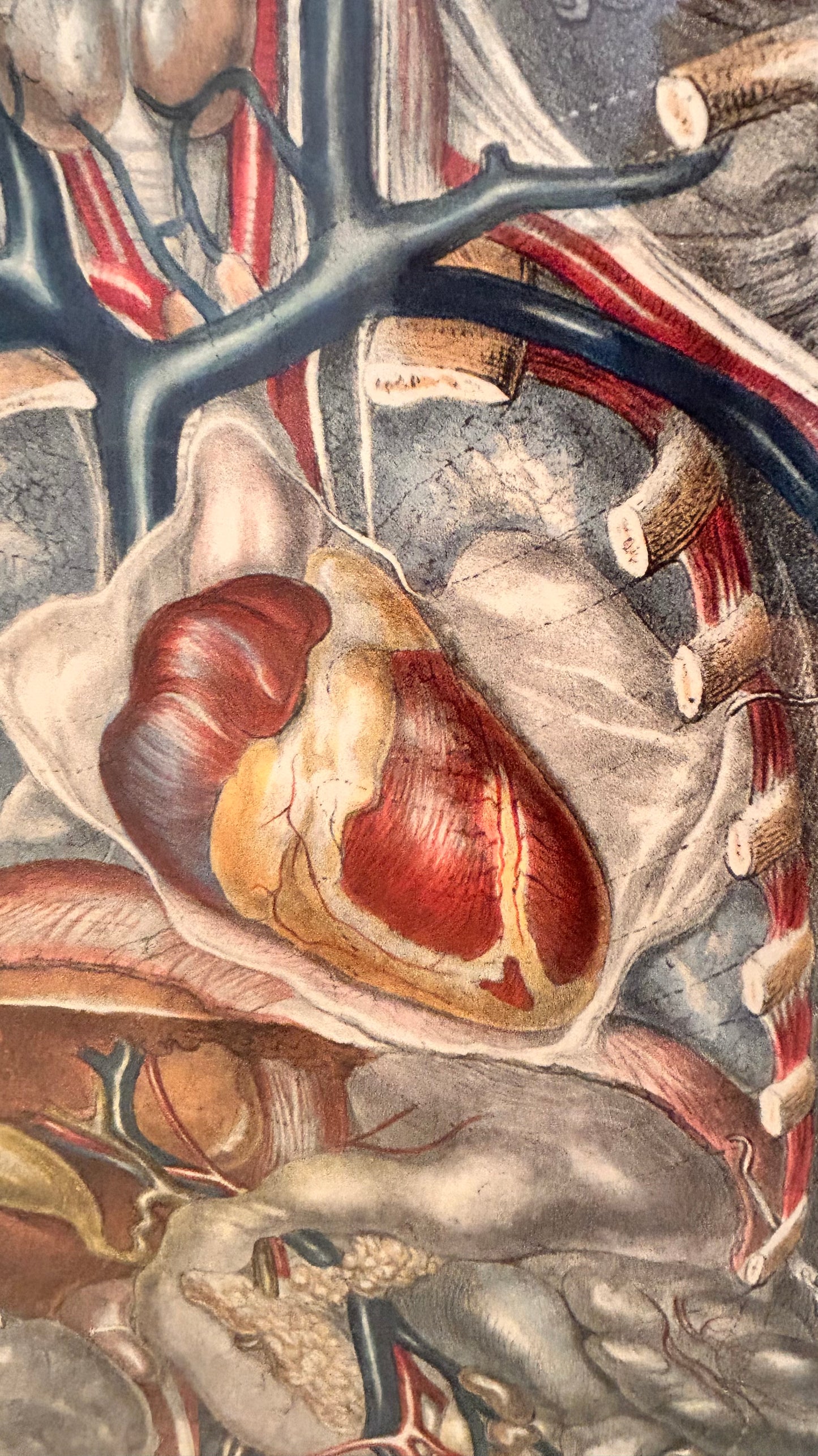 Sibson Anatomical Study Print – Human Torso & Organs, Manchester Royal Infirmary Dissection Plate IV 19th c.
