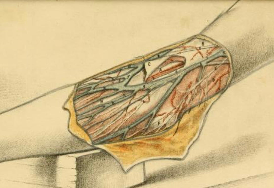 Antike medizinische Illustration | Originale Chromolithografie von George Henry Ford aus dem Jahr 1865