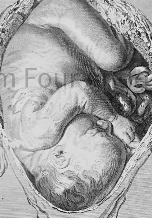 Original 19th-Century Anatomical Print – William Hunter's The Human Gravid Uterus 1851 - William Hunter Anatomical Drawing - Human Gravid Uterus - Tab XX