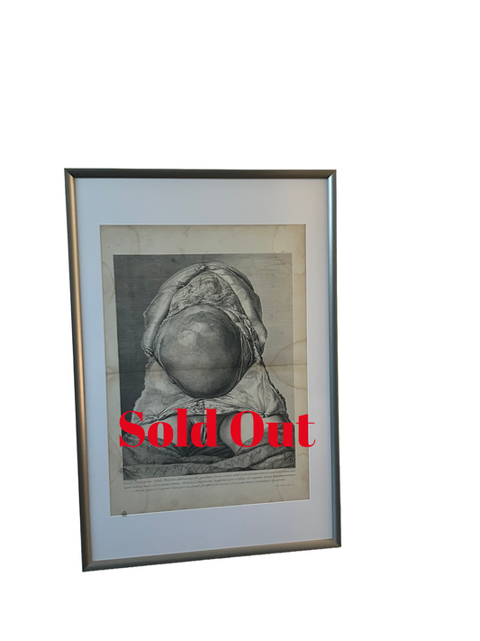 The Anatomy of the Human Gravid Uterus Exhibited in Figures Plate