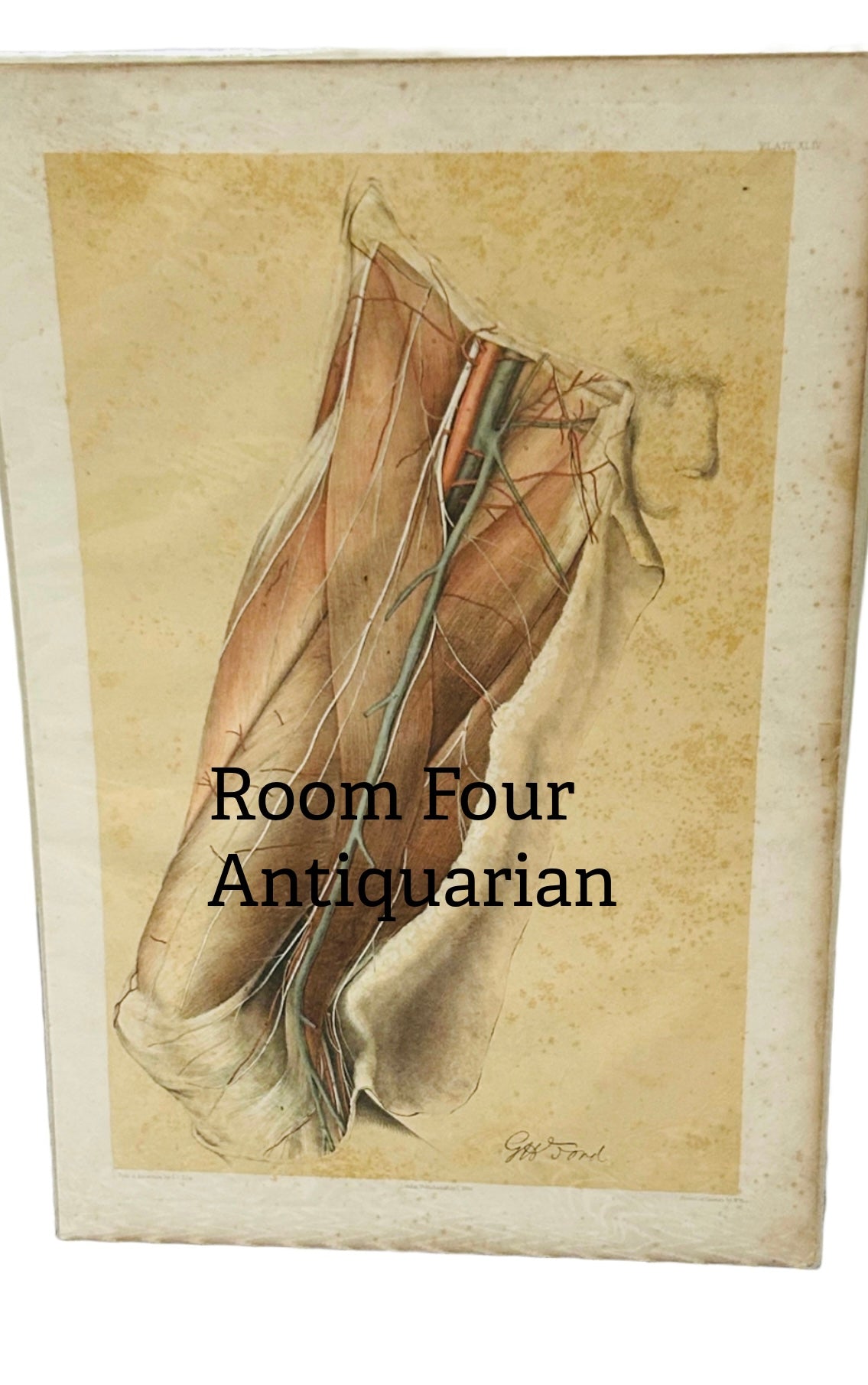 19th Century /Muscular Structures of the Leg Anatomical Drawing, Plate XLIV - Ford 1866