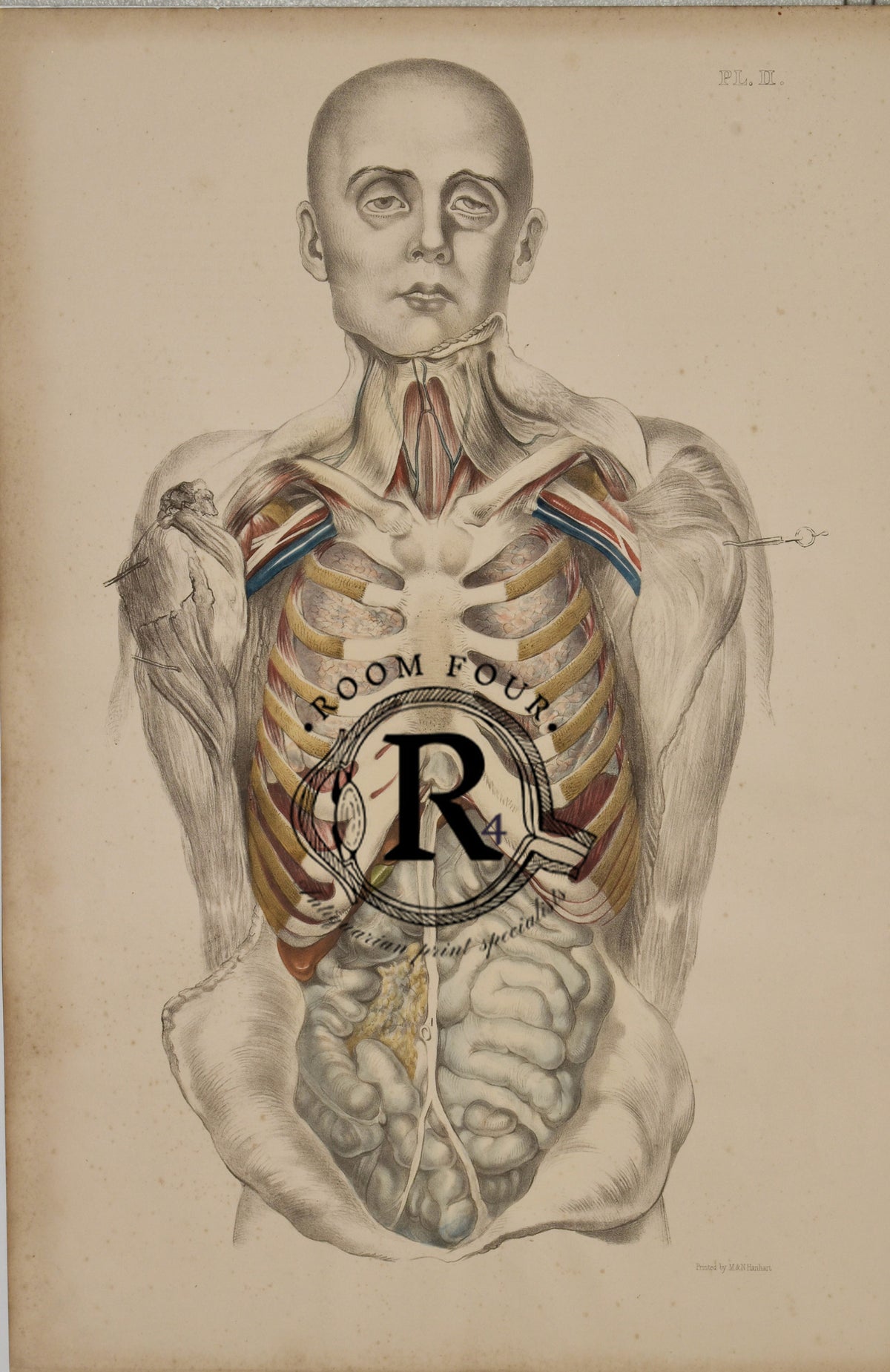 Francis Sibson Anatomist 19th century drawing of a human post Mortem 