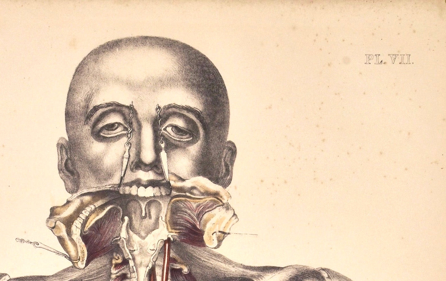 Antique Print Post Mortem Human Muscles, Organs & Vessels (Plate VII, 1800s Sibson Medical Atlas)