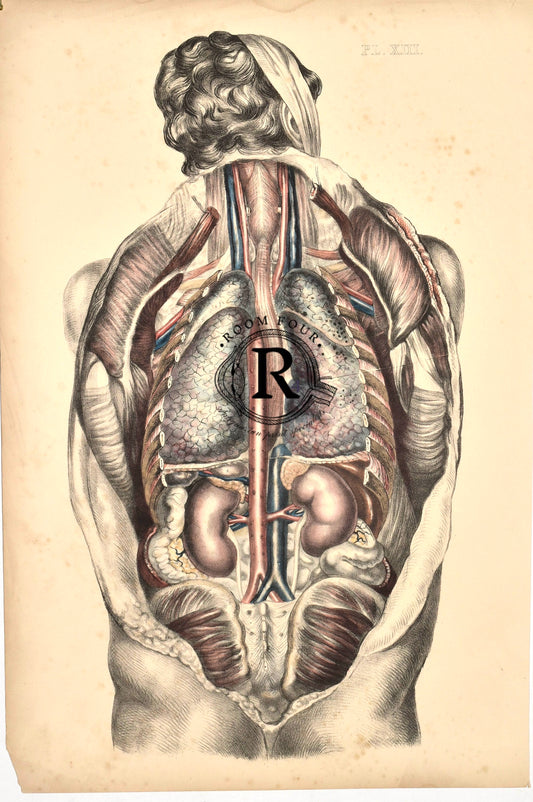 Antique Anatomical Chromolithogh–Sibson Plate XIII, Human Dissection Post Mortem 