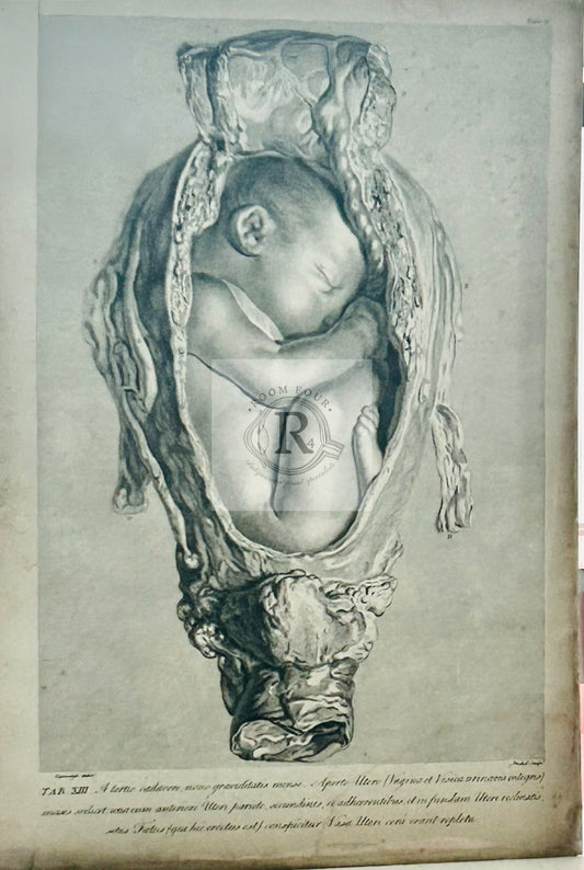 Antique Medical Print - William Hunter 1774 - Full Term Foetus – Plate XIII | Original - Enlightenment