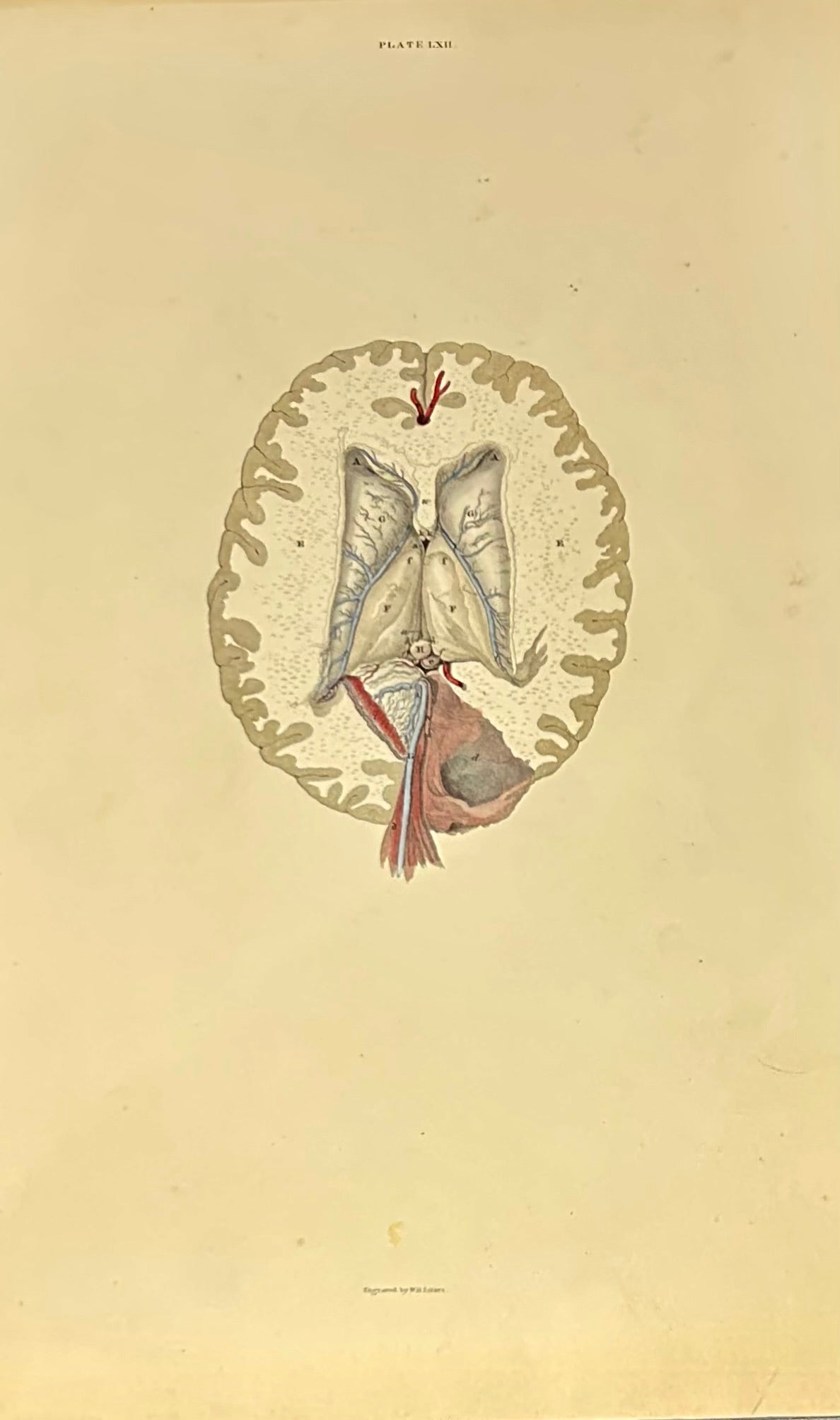 Lizars Anatomical Brain Illustration – Vintage Medical Print (Fine Art) Plate LXII - original anatomical illustration 19th century