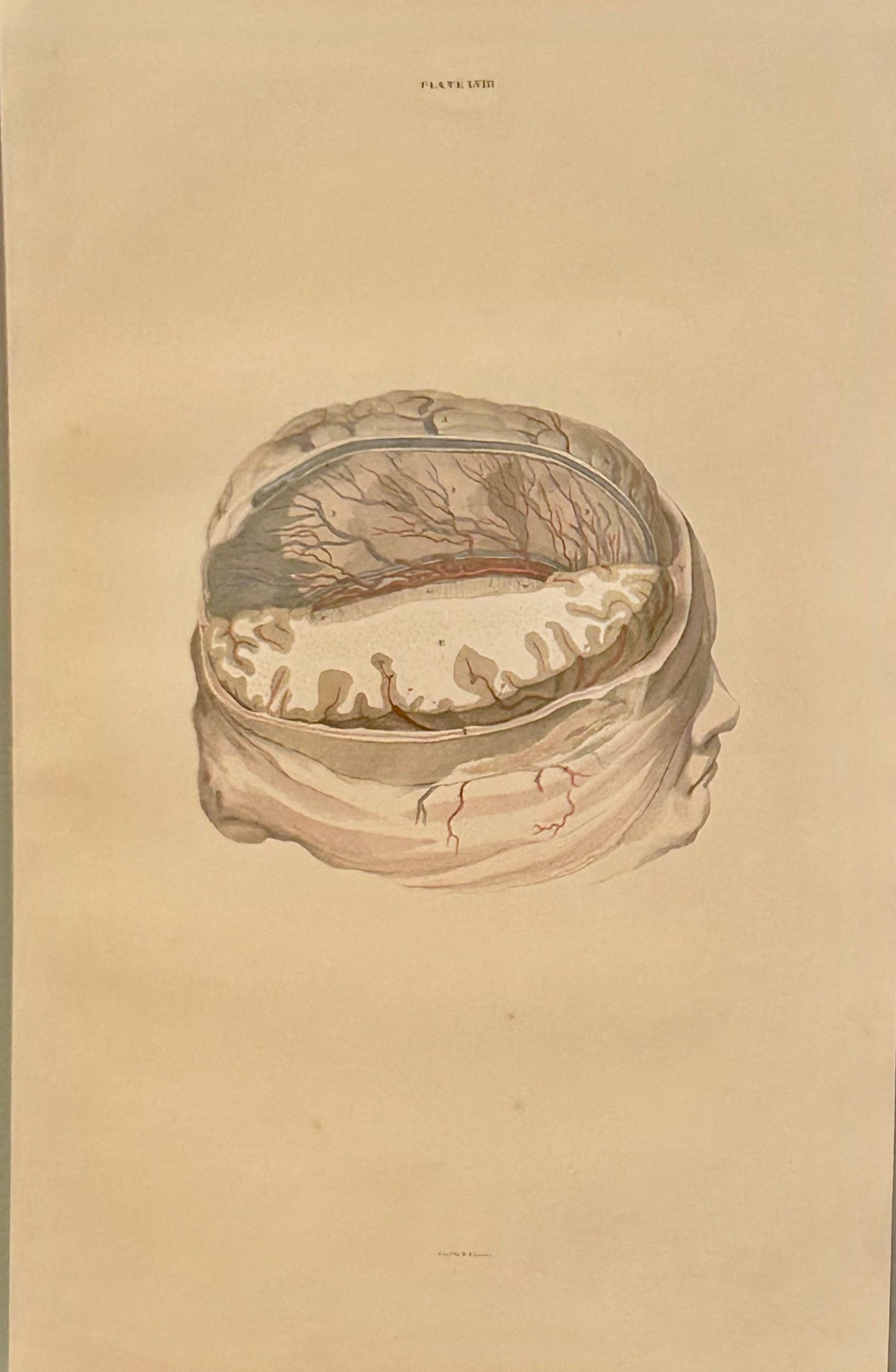 Lizars Anatomical Drawing "The Brain" - early anatomy 19th century  - plate LVIII  - ORIGINAL